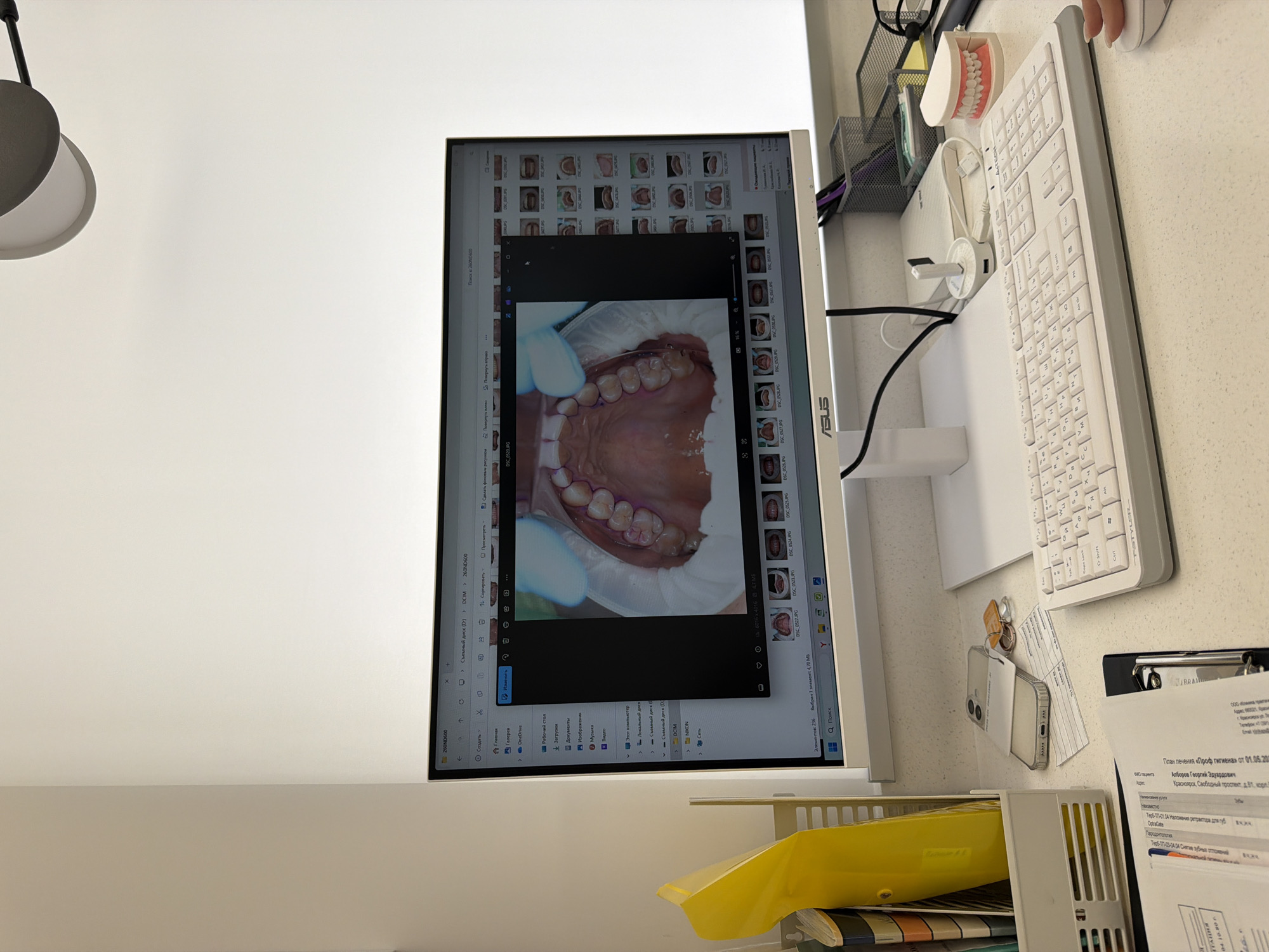 This image depicts a dental office setting. The primary subject is a computer monitor displaying a dental image, specifically an intraoral view of a patient's upper teeth. The computer screen shows a file directory with images of teeth.
Alongside the monitor, there is a white keyboard, a computer mouse, a model of teeth, a smartphone, and paperwork. The document visible is a patient treatment plan for "Prof Hygiene" (Professional Hygiene) from 01.05.20, listing the patient as Алборов Георгий Эдуардович (Alborov Georgiy Eduardovich). The address listed is in Krasnoyarsk, Russia, on Свободный проспект (Svobodny Prospect), building 81.
The surrounding environment is a clinical or office space, indicated by the white walls and general cleanliness. A lamp is visible in the corner. The scene suggests a dentist's workspace.