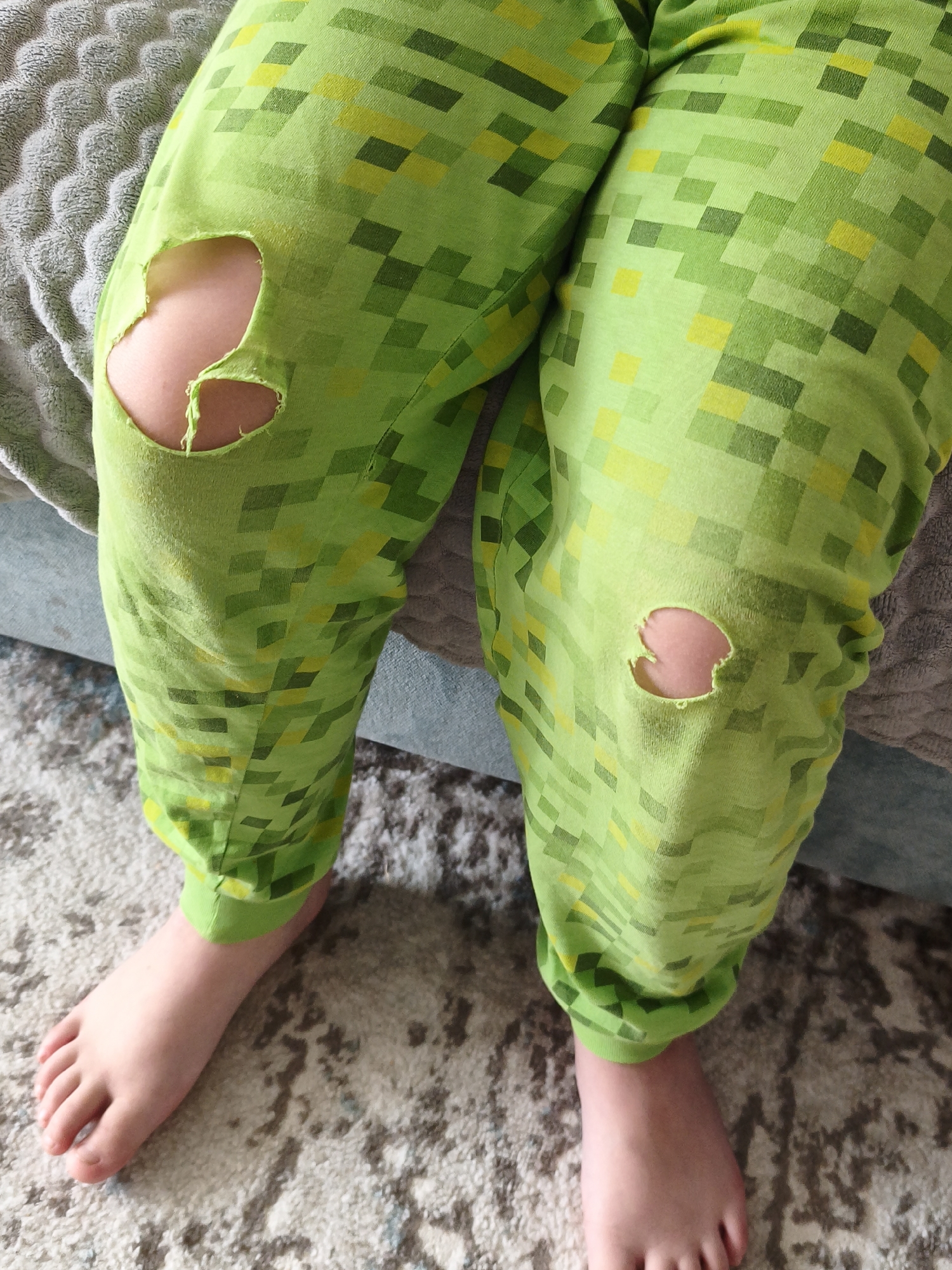 The image shows a close-up view of a person's legs wearing green pixelated patterned pajamas. There are two noticeable rips in the fabric, one on each knee, revealing the skin underneath. The person is barefoot, with their feet resting on a patterned rug. A textured grey blanket is visible behind the legs. The image does not contain enough information to determine a specific location in Chaikovsky, Russia, or any other city.