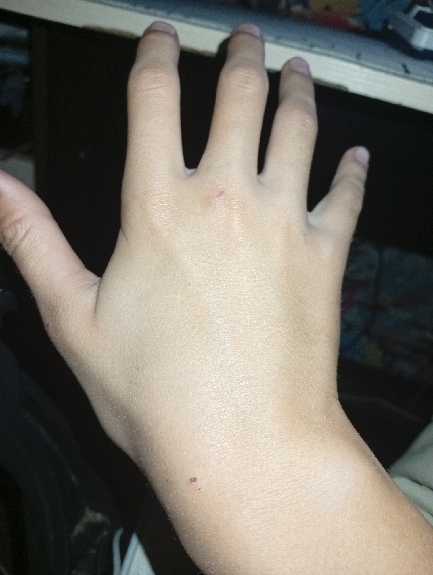 The image shows the back of a person's left hand, with fingers slightly curled. The skin appears fair, with some minor blemishes. A small red mark is visible on the skin near the base of the thumb. The hand is resting on a dark surface, possibly a desk or table, with the edge of a light-colored object, perhaps a laptop or shelf, visible at the top. The background is dark and out of focus, with some indistinct shapes and colors suggesting other objects. There is no indication of the location being in Krasnogorskoye, Russia.