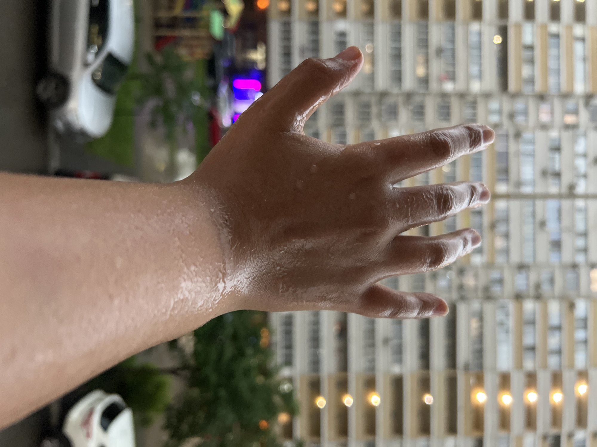 A person's left arm and hand are extended toward the viewer. The skin appears wet, possibly due to rain or moisture. In the background, blurred elements indicate an urban setting. These include buildings with numerous windows, green foliage suggestive of trees or bushes, and glimpses of vehicles like cars. The overall perspective suggests the photo was taken from a height, possibly an apartment or building. I don't have specific information to identify the location as Krasnodar, Russia.