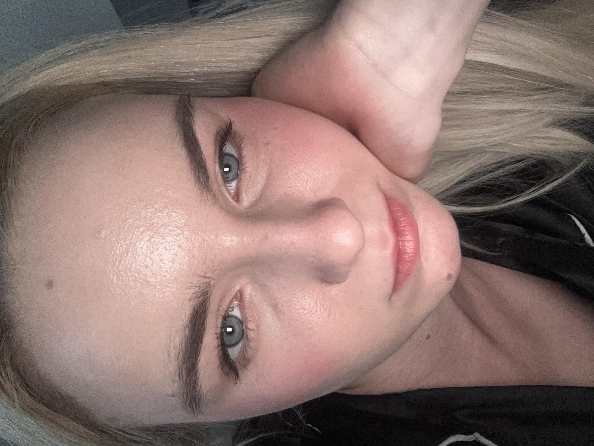A close-up, angled, indoor photograph depicts a fair-skinned individual with light blonde hair and blue eyes. The person is resting their head on their hand. The skin on their face appears smooth and clear. Their lips are slightly parted, revealing a glimpse of their teeth. A mole is visible on the person's left cheek and another one on the lower right side of their face. The person is wearing a black garment with a white stripe on the edge.