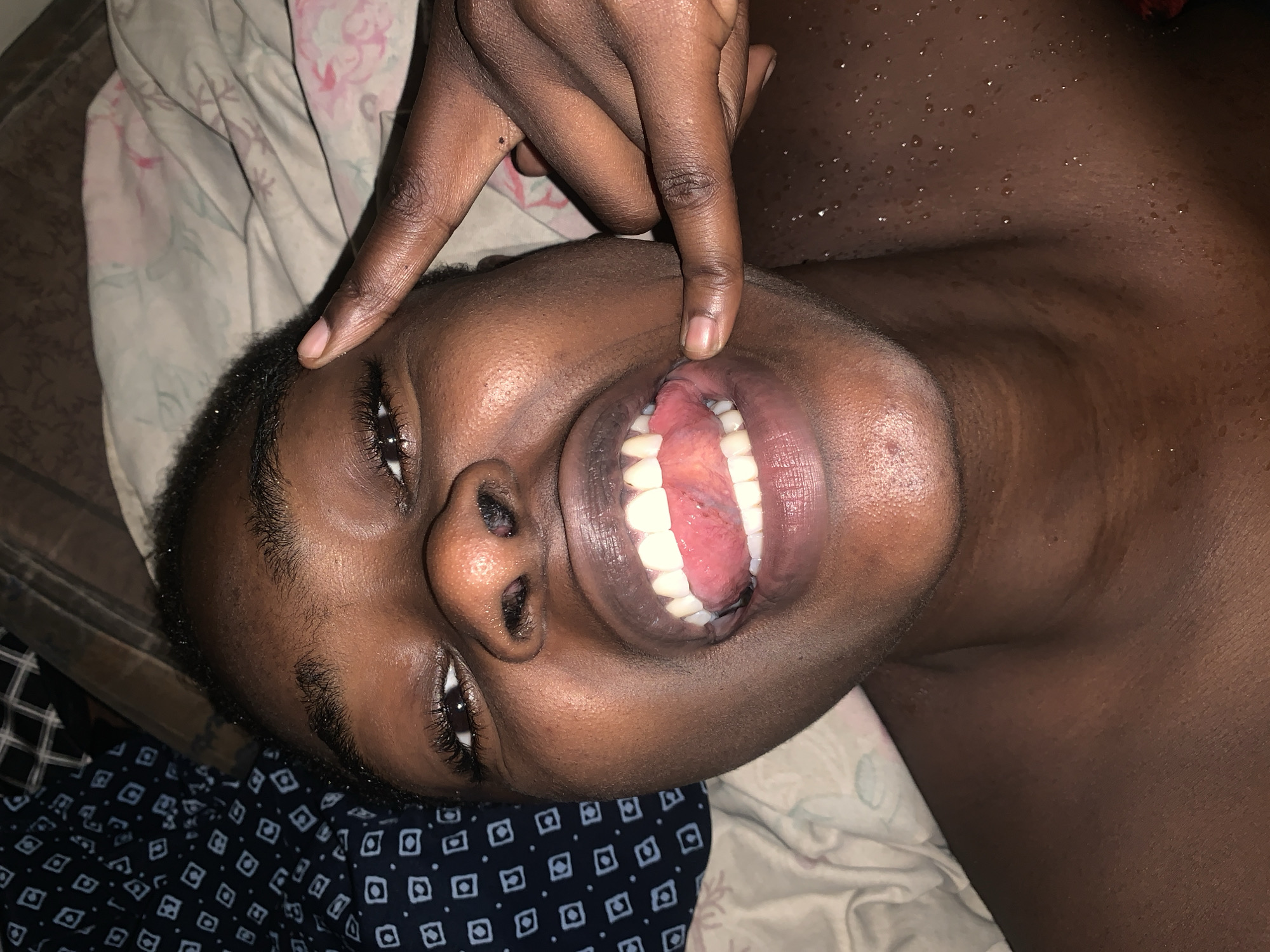 The image shows a close-up, high-angle, dimly lit shot of a person's face and upper chest. The individual appears to be lying down on a bed with patterned sheets. Their mouth is open, revealing teeth and a pink tongue. The person's right index finger is pointing towards their right cheek, and their left index finger is pointing towards their forehead. The skin on their chest and neck appears to be wet, with visible water droplets. The background consists of bedding with a dark blue and white pattern on the left and a lighter patterned fabric on the right. The overall setting suggests an indoor, personal space. There are no visible landmarks or contextual elements that would indicate a specific location within Rafin Par, Nigeria.