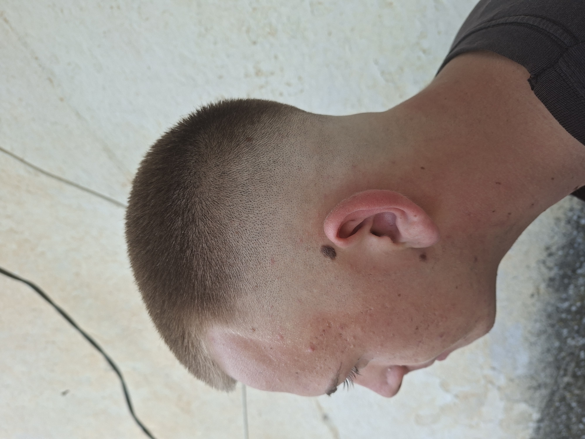 A top-down, close-up view of a person's head and neck. The person has a very short, brown haircut. Their skin is fair with some acne and at least two moles are visible. A black electrical cord is partially visible in the lower left corner. The background appears to be a light-colored tile floor or surface. The photograph was taken at an unknown location and there is no way to verify that it was taken in the city of Svirachi, Bulgaria, as no location information is evident in the image.