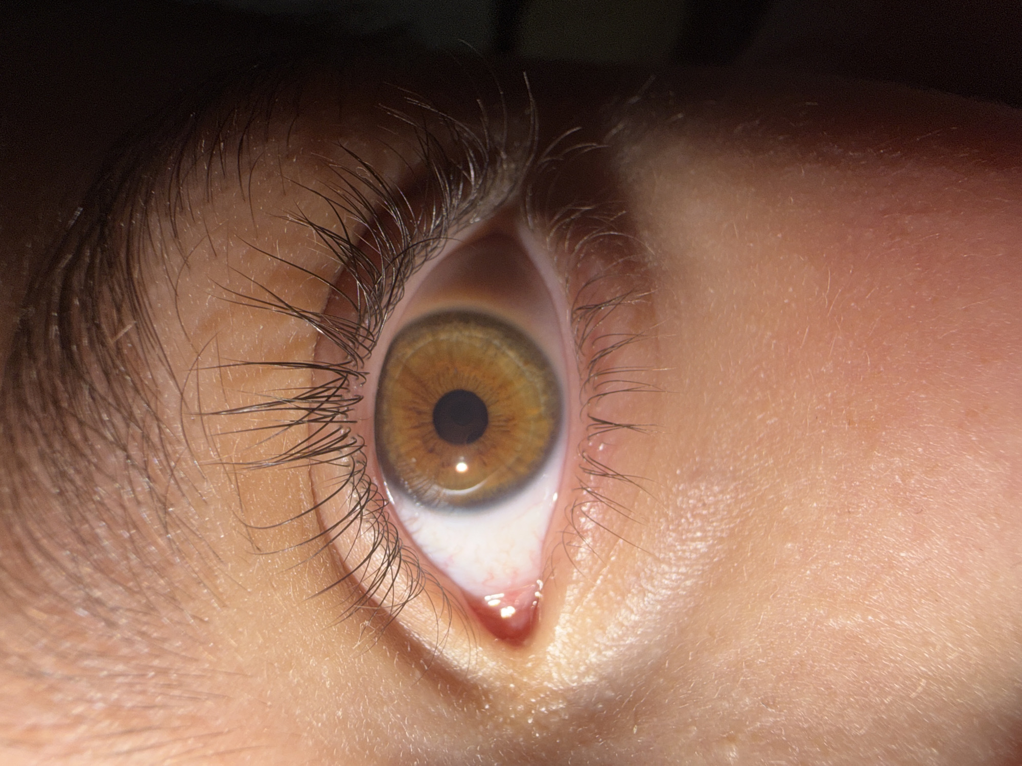 The image is a close-up, macro photograph of a human eye, specifically showing the iris, pupil, eyelashes, and surrounding skin. The iris is a hazel color with variations of brown and green. The pupil is dark and round. The eyelashes are long and dark. The skin appears to be fair-toned with visible pores and fine hairs. The lighting suggests a strong, directional light source, casting some shadows and highlighting the texture of the skin. There is no identifiable context related to the city of Yerevan, Armenia, or any specific location within a city. The image focuses solely on the anatomical features of the eye.
