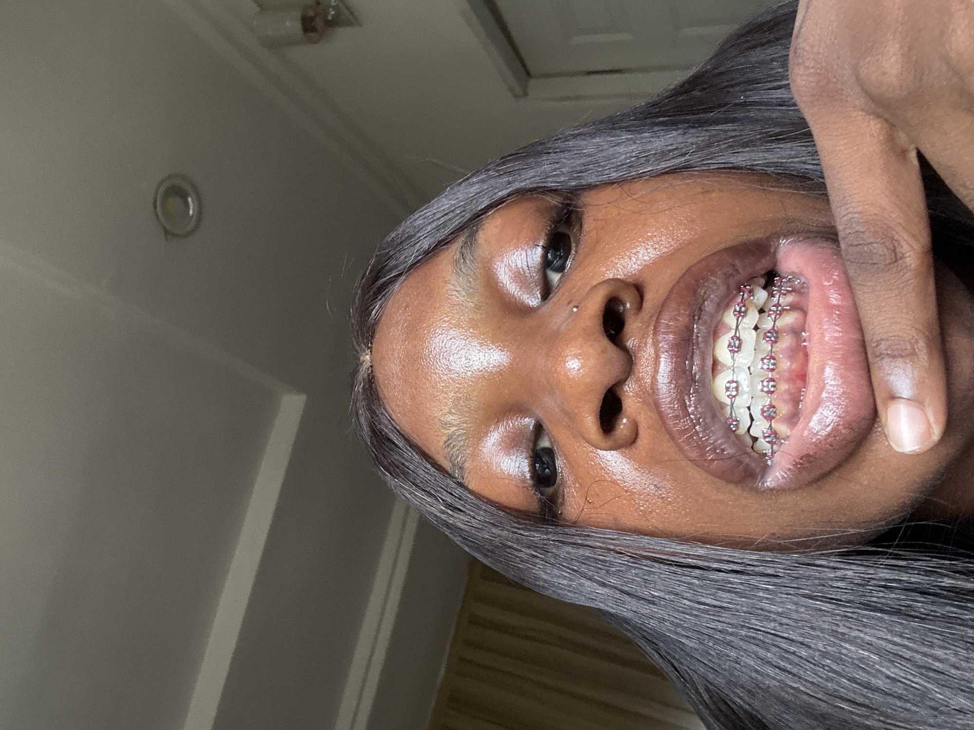 The image displays a close-up, tilted portrait of a person with dark skin and long, straight dark hair. The person is looking slightly upwards, with their face illuminated, showing a subtle sheen on the skin. A small, silver-toned stud nose piercing is visible on their left nostril. Their mouth is open wide, prominently featuring their upper teeth fitted with dental braces that have clear or white brackets and vibrant pink or purple elastic bands. Part of the person's left hand, with fingers, is visible on the right side of their mouth, possibly holding their cheek.
The setting appears to be indoors, with a light-colored ceiling visible in the upper background, featuring a circular recessed light fixture. Other subtle architectural details, like lines on a wall, can be seen in the background, suggesting a room with light gray or white walls. The lighting is consistent with artificial indoor illumination. The overall impression is a casual, selfie-like photograph, possibly taken to show the dental braces. The activity is a direct gaze and presentation of the braces. No text is visible in the image. This scene takes place in Abuja, Nigeria.