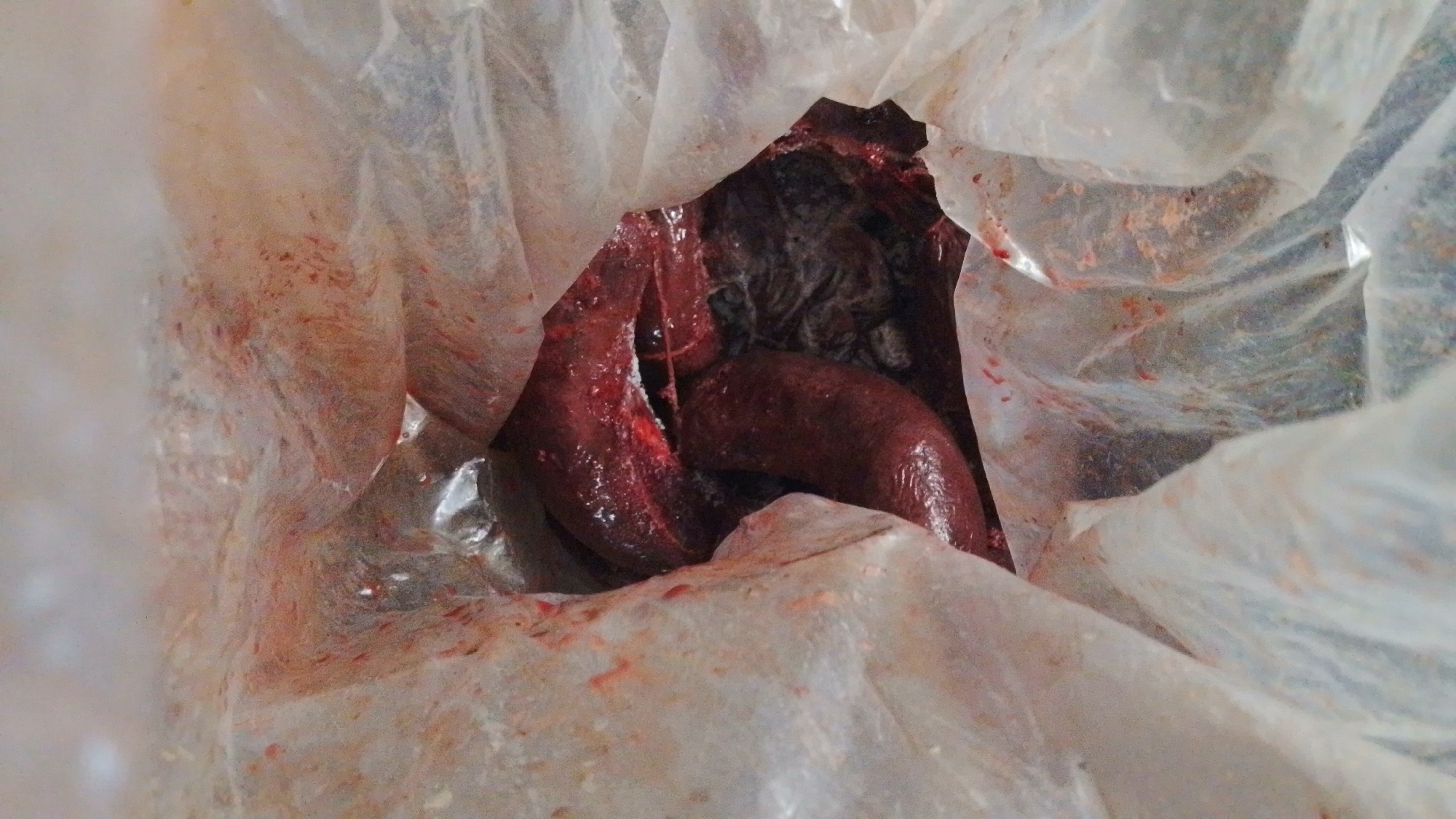 The image displays a close-up view looking down into a translucent, crumpled plastic bag. The interior surface of the bag is heavily stained with reddish-brown smudges and streaks, suggesting the presence of blood or meat juices. Inside the bag, a dark reddish-brown mass of organic material is visible. The most prominent feature is an elongated, curved, and somewhat tubular object, possibly an animal intestine or another visceral organ, which appears moist and glistening. Adjacent to and partially obscured by this object are darker, more amorphous clumps of material, resembling clotted blood or other organic matter. The folds of the plastic bag frame the central contents, with some areas appearing blurred due to shallow depth of field. There are no people or other identifiable objects, and no text is visible. The scene captures the raw aftermath of butchering or the handling of animal offal, possibly for food preparation or disposal. The image provides no specific time of day, weather conditions, or visual location cues, although the context provided places it in Tinaquillo, Venezuela.
