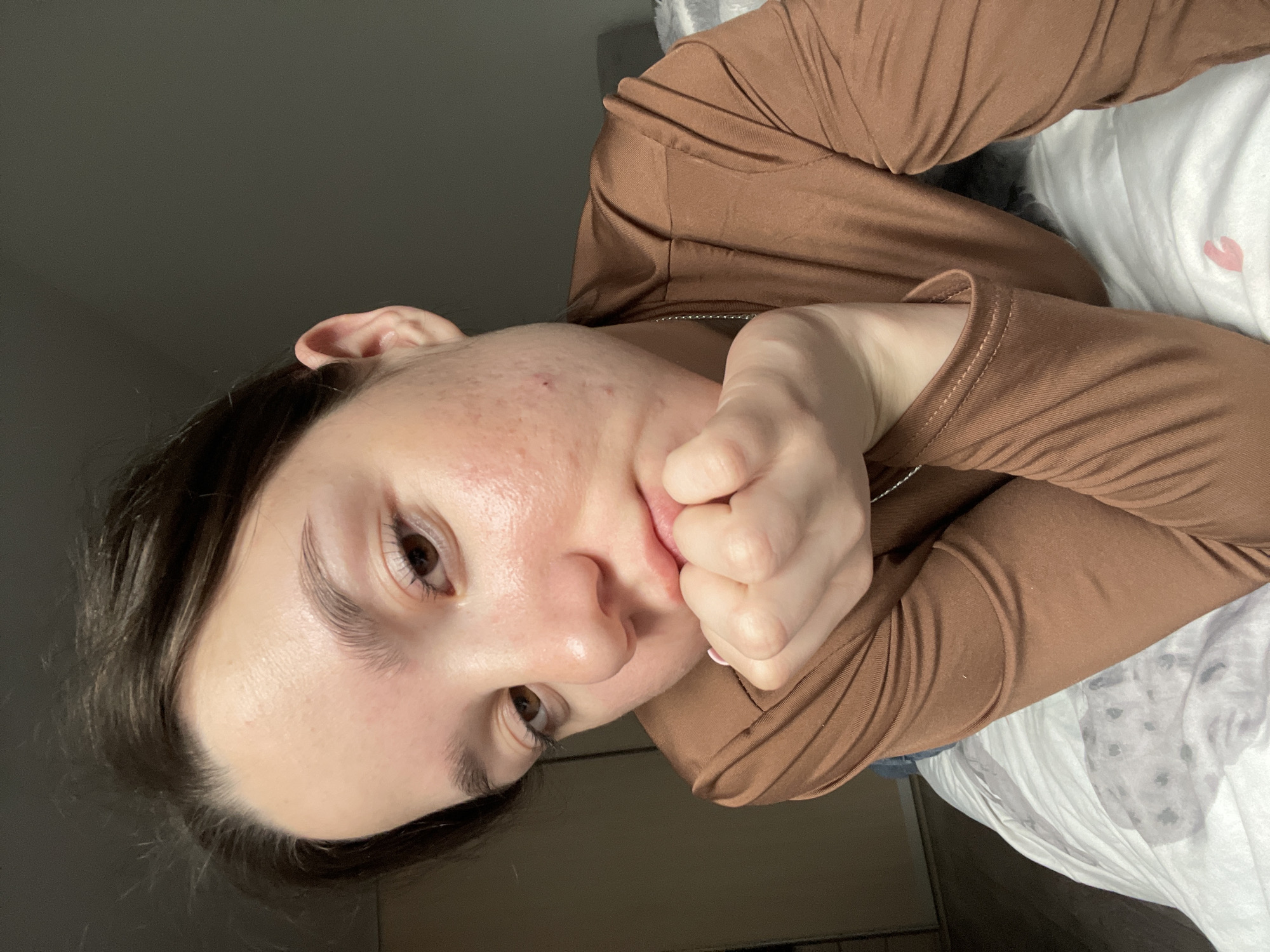 A young adult female is depicted in a close-up, chest-up shot, lying or propped up in an indoor setting within the city of Chaikovsky, Russia. Her dark brown hair is pulled back, revealing a fair complexion with visible redness and acne on her cheeks and forehead. Her brown eyes gaze slightly downwards, and her lips are slightly parted. She is wearing a fitted, long-sleeved, brown-colored top and a thin silver-colored chain necklace. Her right hand is fisted and supports her chin, contributing to a pensive expression. She lies on white bedding featuring a light gray/purple abstract pattern and a distinct pink lipstick mark in the shape of lips towards the bottom right of the frame. The background is dimly lit and out of focus.