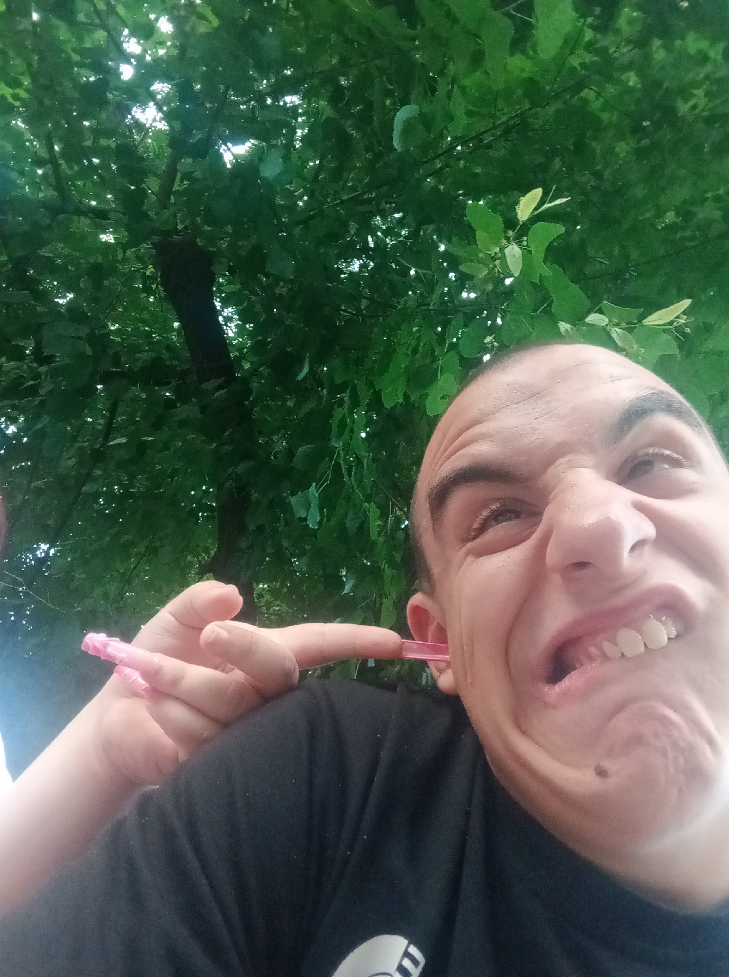 In Stamboliyski, Bulgaria, a close-up, low-angle selfie shows a man with a distorted facial expression, his mouth wide open and teeth visible, as he appears to be cleaning his ear with a pink object, possibly a cotton swab or similar item. His left hand is visible, holding the object and inserted into his ear. The background is dominated by the dense green foliage of trees, suggesting an outdoor setting, possibly a park or garden. The lighting indicates it is daytime.