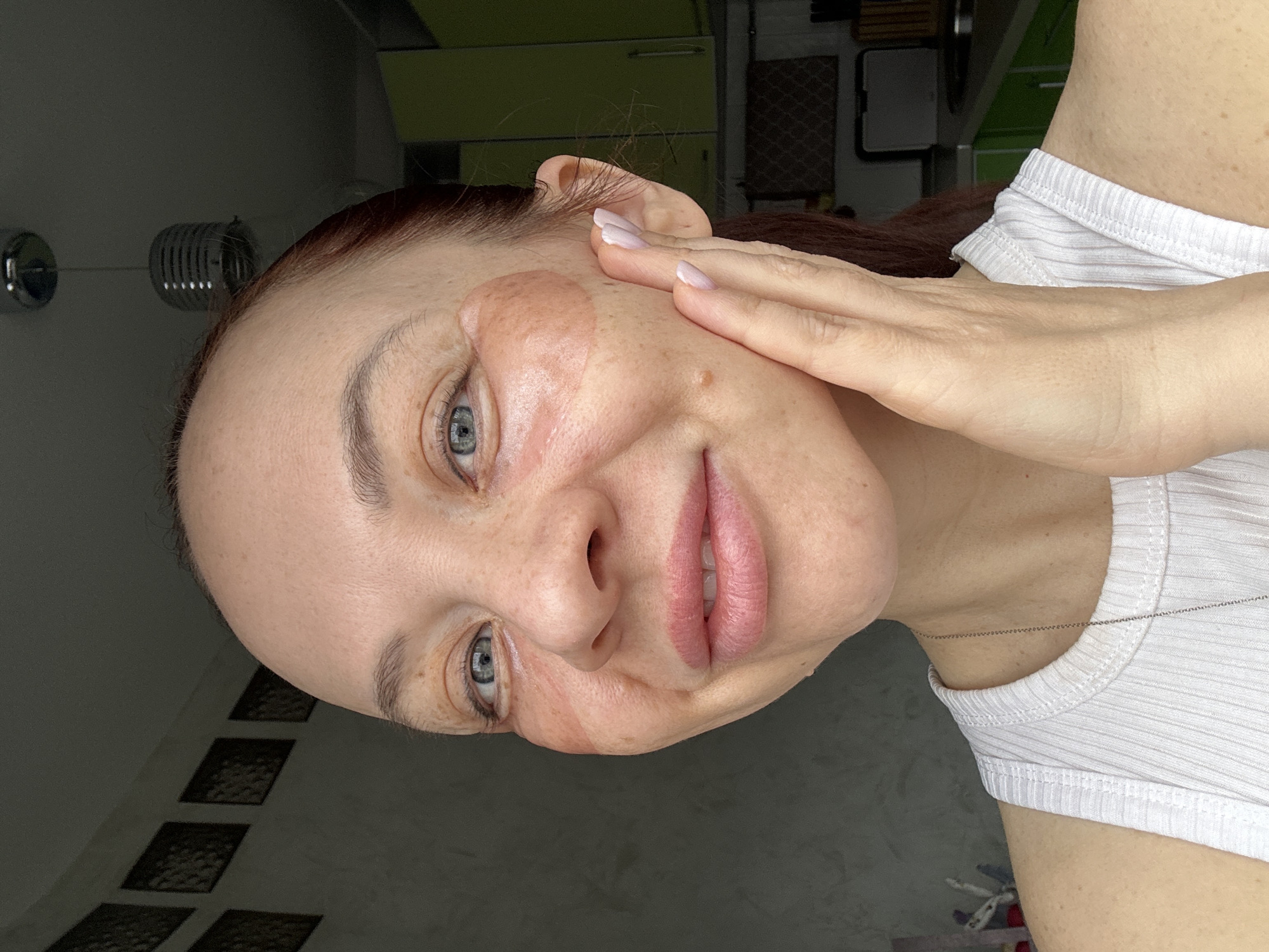 A woman is pictured close-up, posing with her hand touching her face. She has fair skin, light blue eyes, red hair and is wearing a white shirt and silver chain. Her fingers have light pink manicured nails. She has a reddish-brown patch around her eye and cheek. The background includes an interior, with visible kitchen cabinets and a lighting fixture on the wall. The floor features geometric shapes. The location is Chaikovsky, Russia.