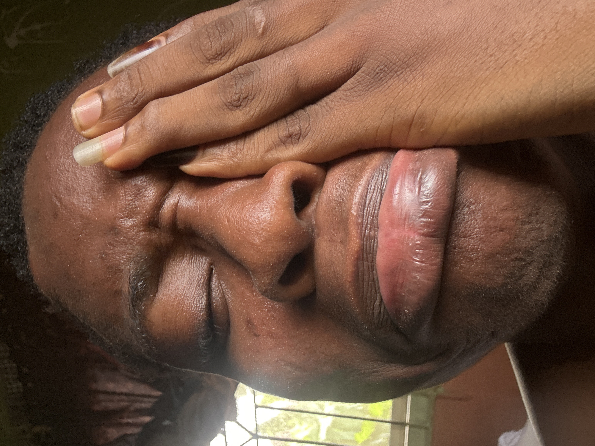 This close-up, vertically oriented photograph captures a person with dark skin, rotated 90 degrees clockwise. The subject's left hand is placed over their eyes and forehead, covering the upper part of their face. Their mouth is slightly open, with the tongue partially protruding. The facial expression appears to convey strong emotion, possibly distress, exhaustion, or intense concentration.
Notable details include the person's skin texture, which is visible in high detail, and some short, dark hair along the jawline and chin area. The fingernails of the hand covering the face are long, clear, and well-maintained. The background is largely out of focus, but hints at an indoor setting with natural light streaming in, revealing a window with vertical bars and green foliage visible outside. The lighting suggests it is daytime. There is no visible text in the image.