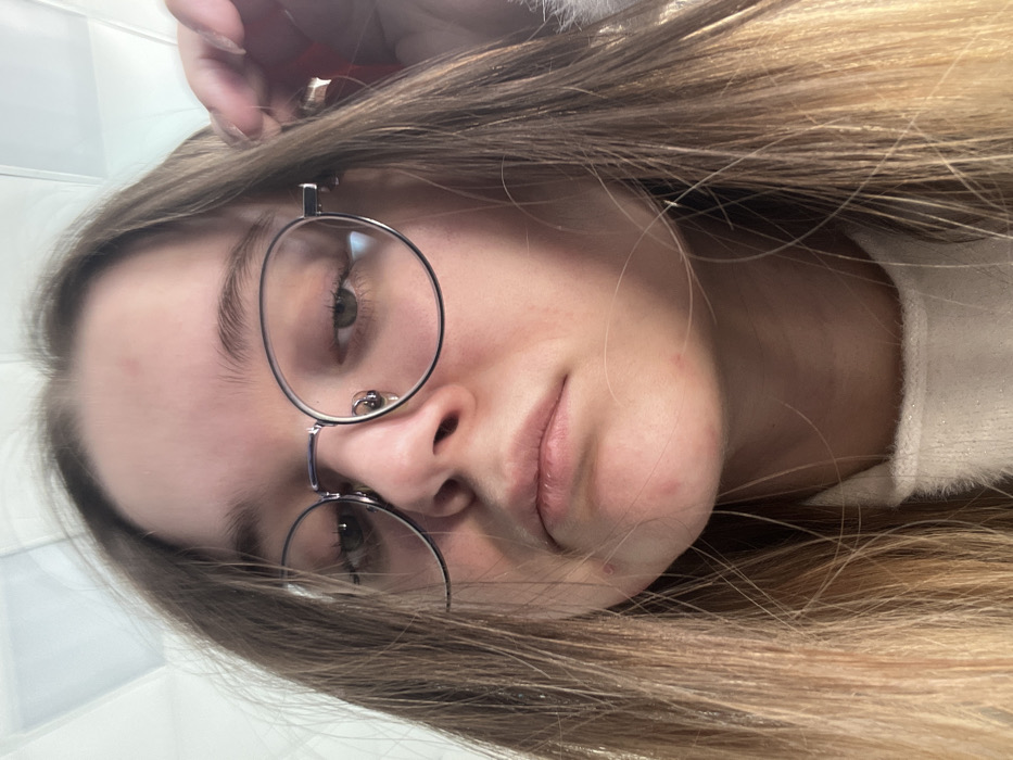 The image displays a close-up, head-and-shoulders portrait of a young individual, likely female, with fair skin and long, light brown hair with blonde highlights, parted centrally. The individual wears silver-rimmed, round spectacles, through which light-colored eyes are visible, looking slightly downwards. The facial expression is neutral. Minor reddish blemishes are present on the forehead and chin. The individual's left hand (viewer's right) is partially visible near the right side of the head, appearing to touch or adjust hair or the glasses' earpiece. A section of a light-colored, possibly white or cream, soft-textured garment is visible around the neck and chest area. The background is indistinct and appears to be an indoor setting, with a portion of a white ceiling featuring rectangular panels or tiles visible at the top. The image does not contain any visual information that allows for the identification of a specific location within the city of Большевик, Russia.