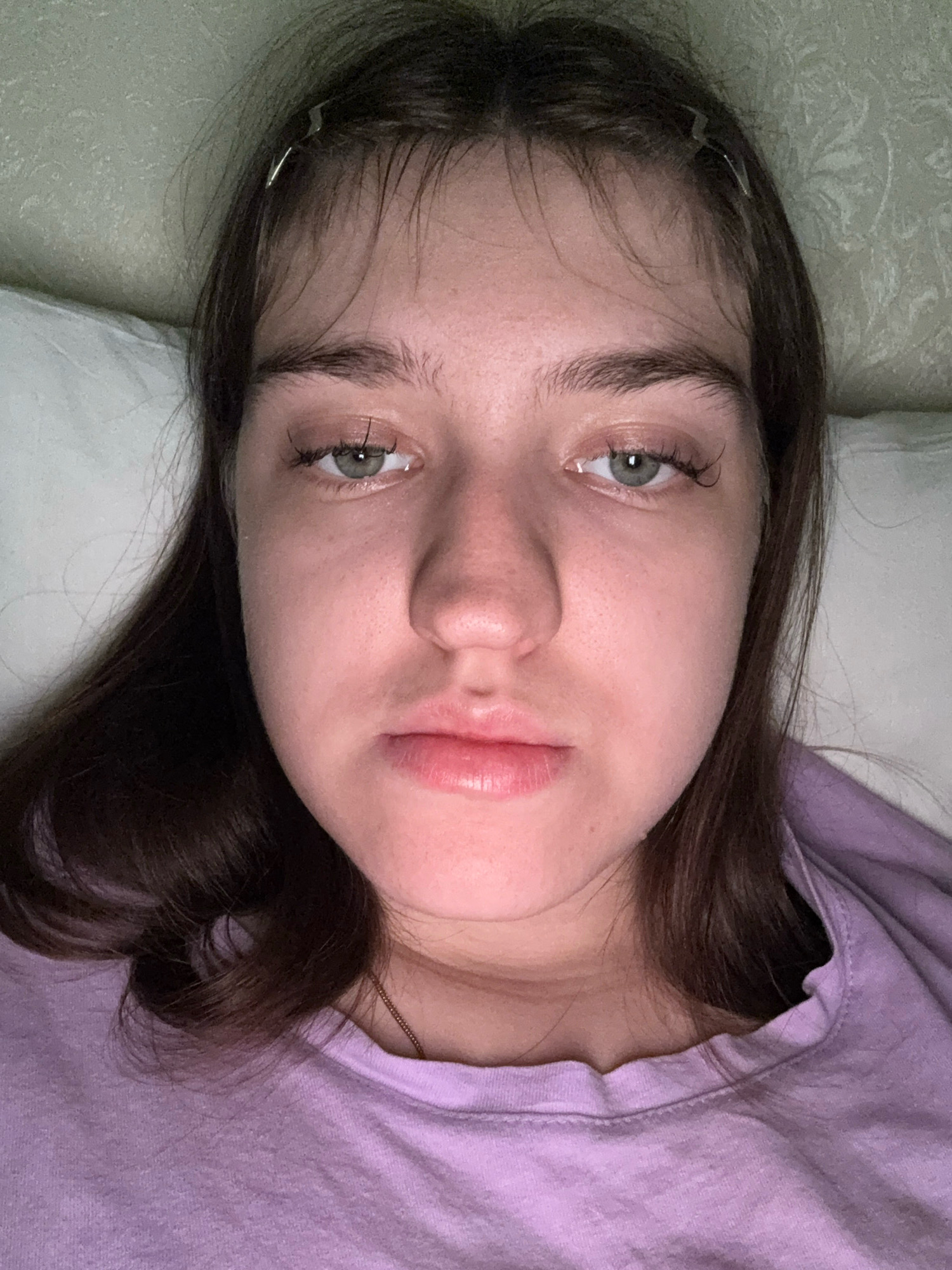 The image shows a close-up, frontal view of a young Caucasian female lying down, likely in bed. Her eyes are open, and she is looking directly at the camera. She has light brown hair, some of which is pulled back from her face with a silver hair clip. Her skin tone is fair, with some redness on her cheeks and a scattering of freckles across her nose. She is wearing a pale purple t-shirt, and a thin gold chain is visible around her neck. The background consists of a white pillow and a textured, pale green wall. The lighting appears to be soft and ambient. There is no indication of the city of Zavolzhye, Russia, or any other specific location in the image.