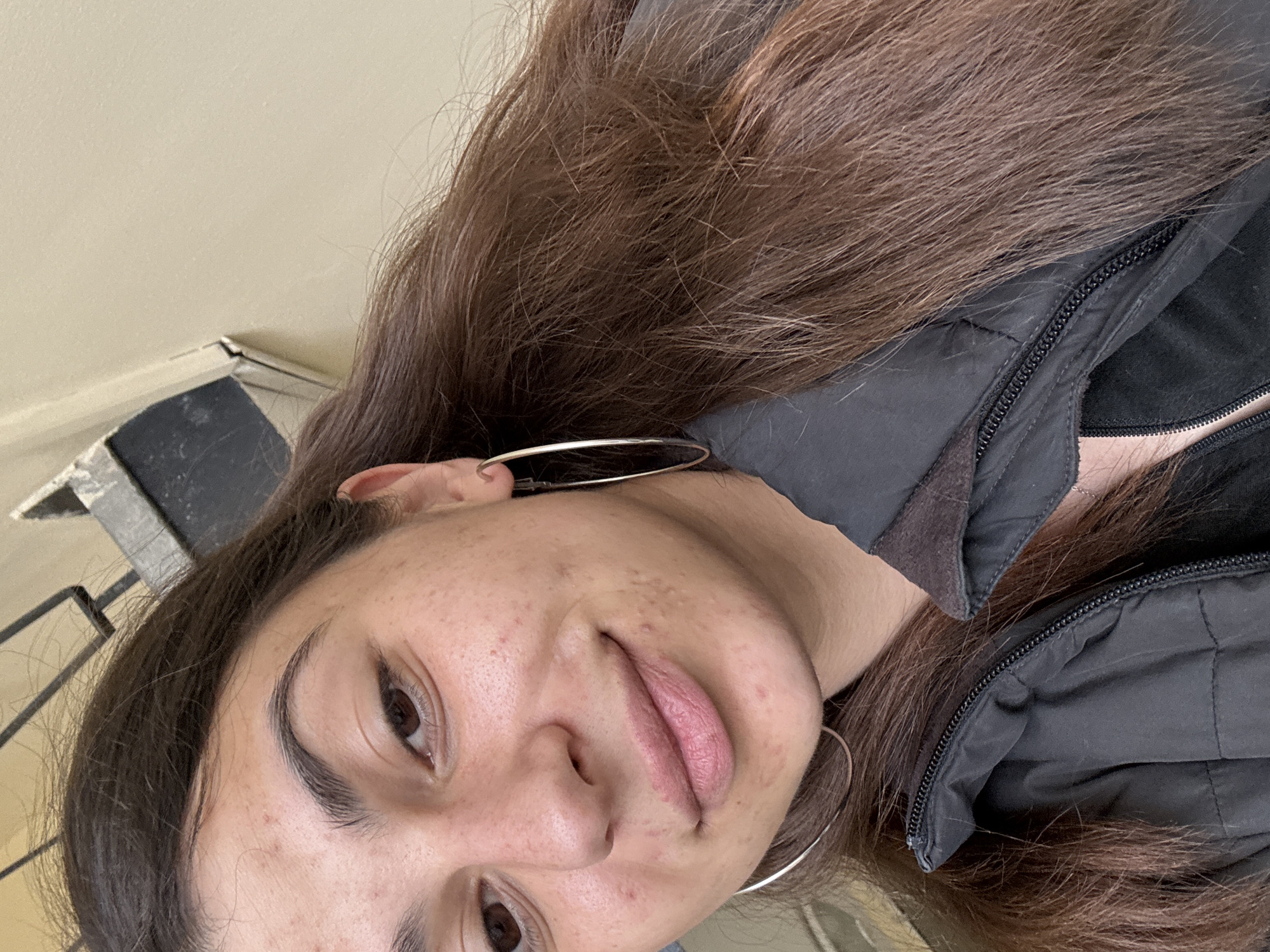A close-up selfie of a woman with long brown hair, wearing silver hoop earrings and a black puffer jacket. Her skin appears to have some acne and redness. The background is a beige wall and a partially visible object, possibly a window frame. The image provides no discernible information to confirm its location as Plovdiv, Bulgaria.