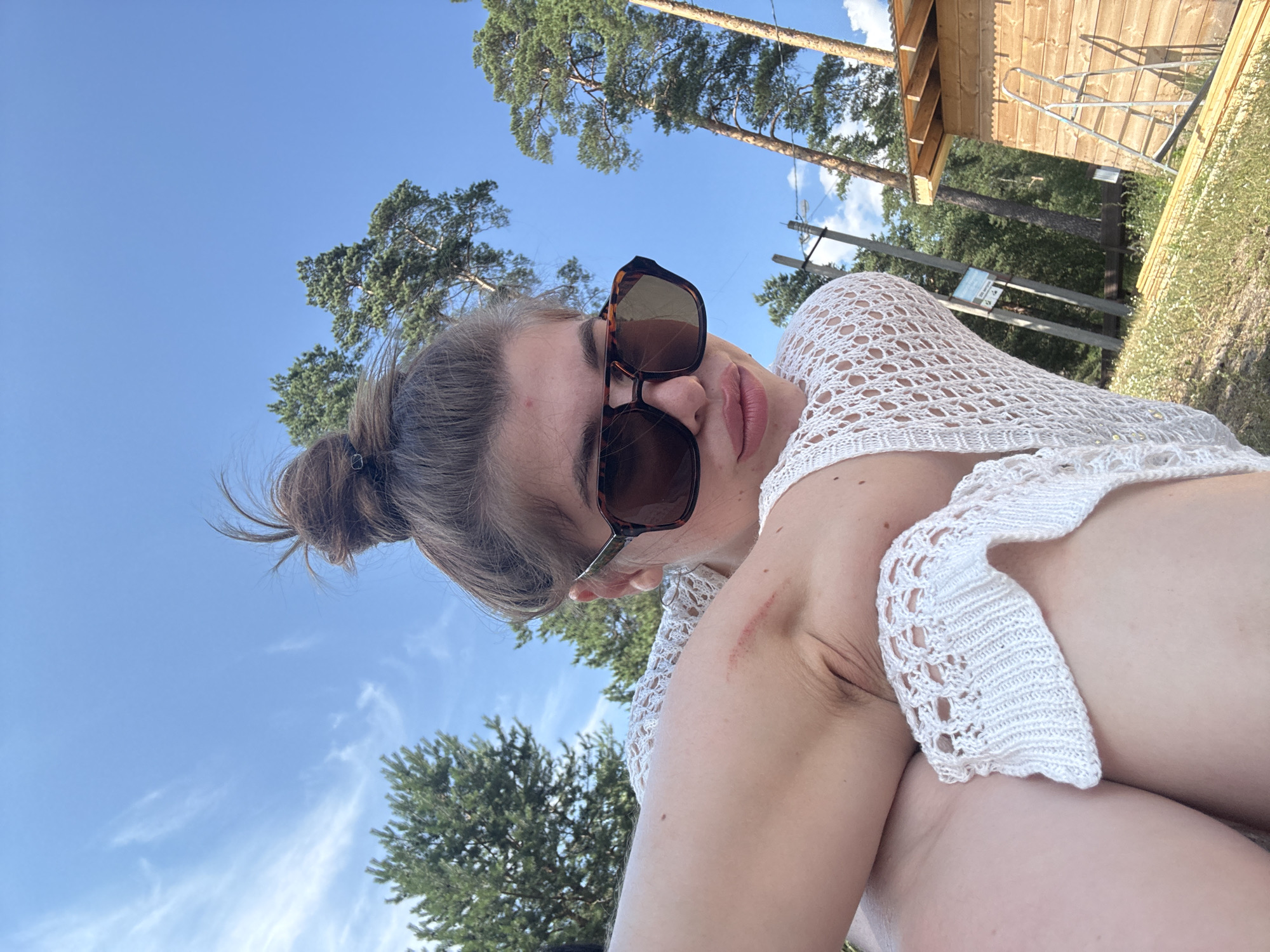 A woman is captured in a selfie with a bright blue sky and green trees in the background. She is wearing large, tortoiseshell sunglasses and a white crocheted top. Her hair is pulled back in a bun. Her left arm is bent, and a scratch is visible on her upper arm. In the background, a wooden structure with a ladder can be seen, suggesting an outdoor, possibly recreational, setting. The lighting indicates it is daytime, likely sunny. The overall mood appears relaxed and casual.
