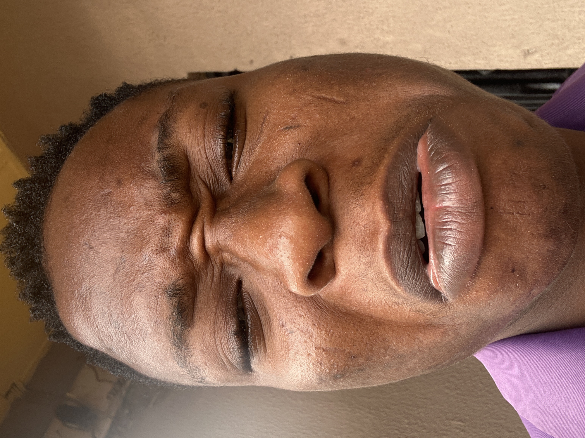Close-up of a Black man's face, eyes closed, mouth slightly open. Skin appears dark brown with minor scarring on the forehead and chin. Hair is short and curly. The man is wearing a purple garment. The location in Ikorodu, Nigeria is unknown.