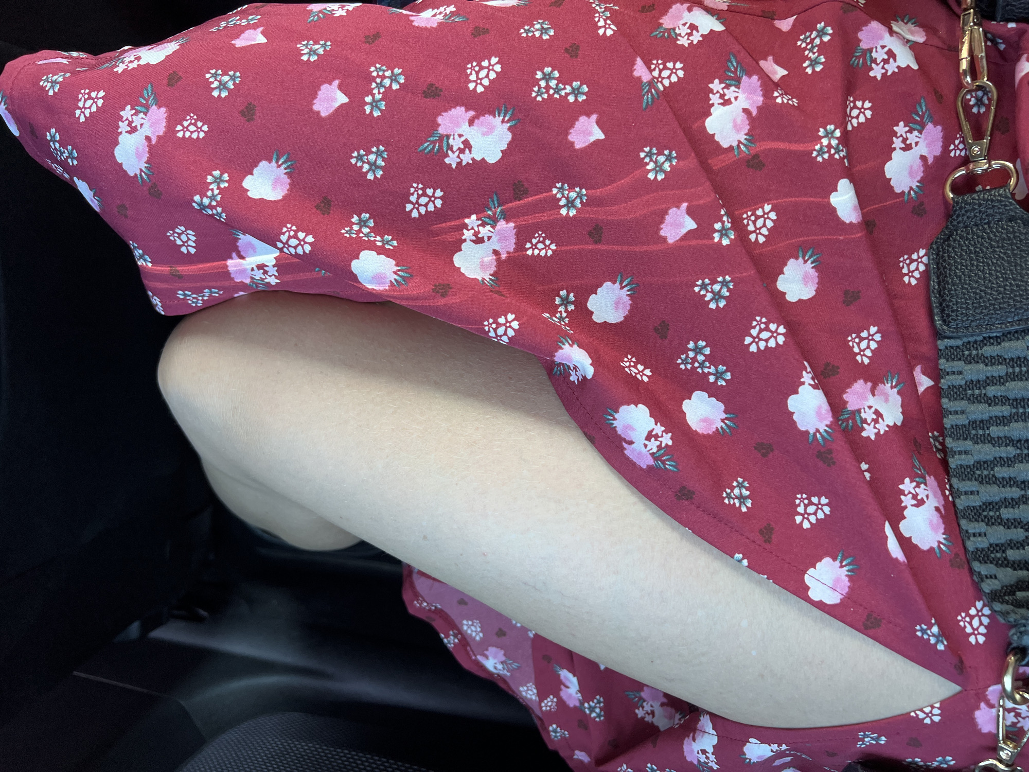The image depicts a person's bare leg and a portion of a red floral dress, seen from an elevated perspective within what appears to be a vehicle's interior, in Cassano delle Murge, Italy. The central focus is on a fair-skinned leg, likely the thigh and knee area, positioned on the left side of the frame. The skin exhibits a smooth texture with minor visible hair follicles and subtle, lighter discolorations. Covering the lower and right portions of the frame is a red dress featuring a repeating pattern of stylized white and pink flowers, some with green accents, along with smaller dark brown shapes. Distinct parallel rays of sunlight are visible across the fabric of the dress. In the bottom right corner, a black and grey patterned strap, secured by a metallic gold-colored clasp, is partially visible, suggesting a bag. The background is dark and indistinct, consistent with the shadowed interior of a car, with a textured black surface on the far left, possibly an upholstered seat or door panel.