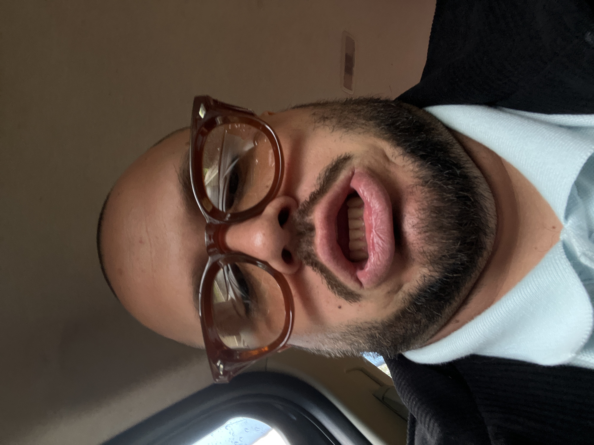 A man with a bald head, brown beard, and brown glasses is looking directly into the camera with his mouth open. He is wearing a light blue polo shirt under a dark-colored jacket. The photo was taken from a low angle, possibly inside a vehicle. The location is Unknown, Unknown.