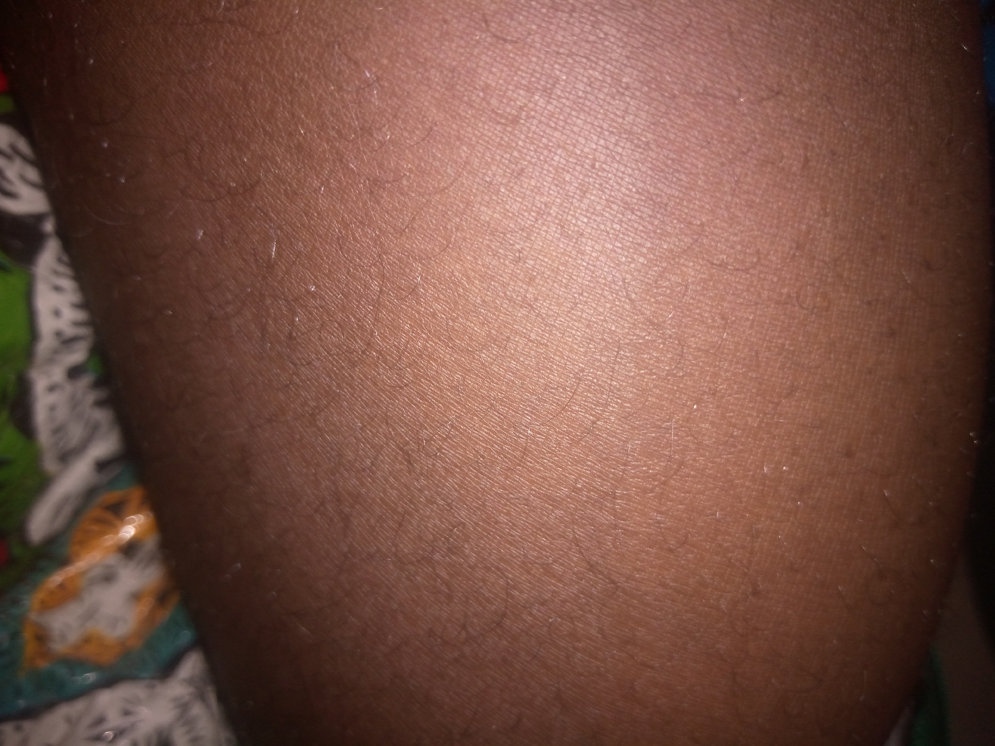 The image shows a close-up view of human skin, likely a leg or arm, with visible pores and fine hairs. The skin tone is medium brown. In the background, out of focus, a colorful fabric with a patterned design is visible, suggesting the person might be wearing clothing or sitting on a patterned surface. The lighting creates subtle highlights and shadows on the skin's texture. The image does not contain any elements that would indicate its location within the city of Jalingo, Nigeria.
