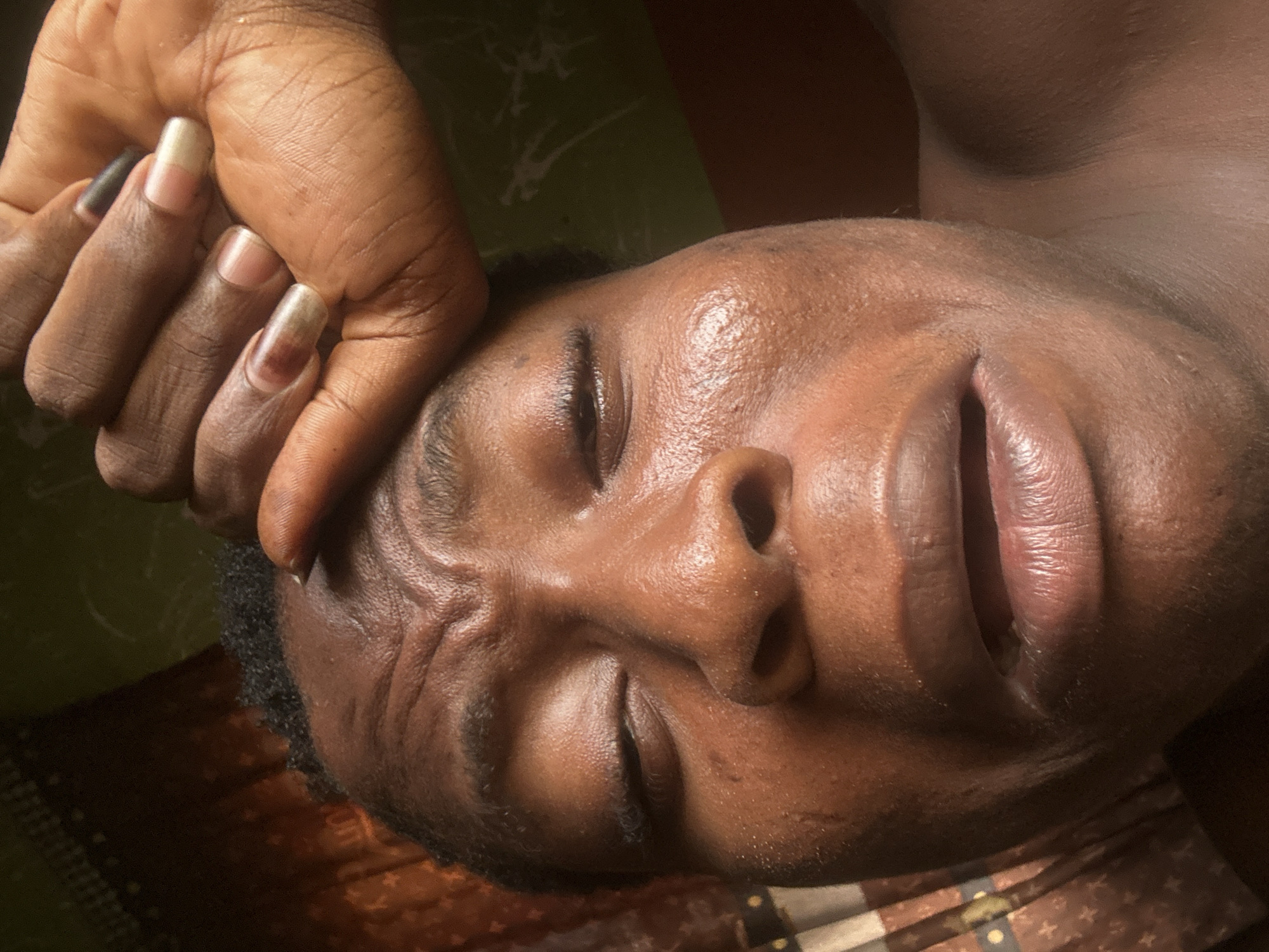 A close-up, indoor shot shows a dark-skinned person lying down with closed eyes, possibly sleeping or unconscious. A hand is resting on their forehead. The setting is likely a bedroom, given the presence of a patterned surface underneath the person. The location is unknown.