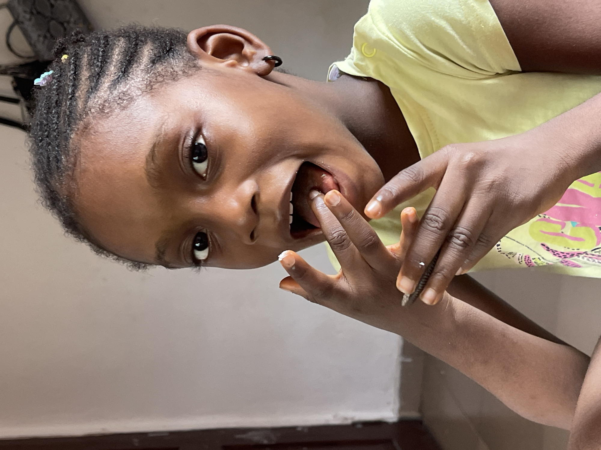 In Ado, Nigeria, a young female subject with dark skin, braided hair adorned with multiple colorful butterfly clips, and black hoop earrings is captured in a medium close-up, indoor shot. Her mouth is open wide, revealing her tongue and teeth, as she looks directly at the camera. Her right index finger is positioned near her mouth, bearing a small white particulate residue. Her left hand grasps a dark, slender, ridged object; fingernails on this hand exhibit a reddish-orange discoloration. She wears a light yellow t-shirt. The background consists of a plain, light-colored wall, with a dark brown door frame visible on the far left. A dark, indistinct object hangs partially visible in the upper right background.