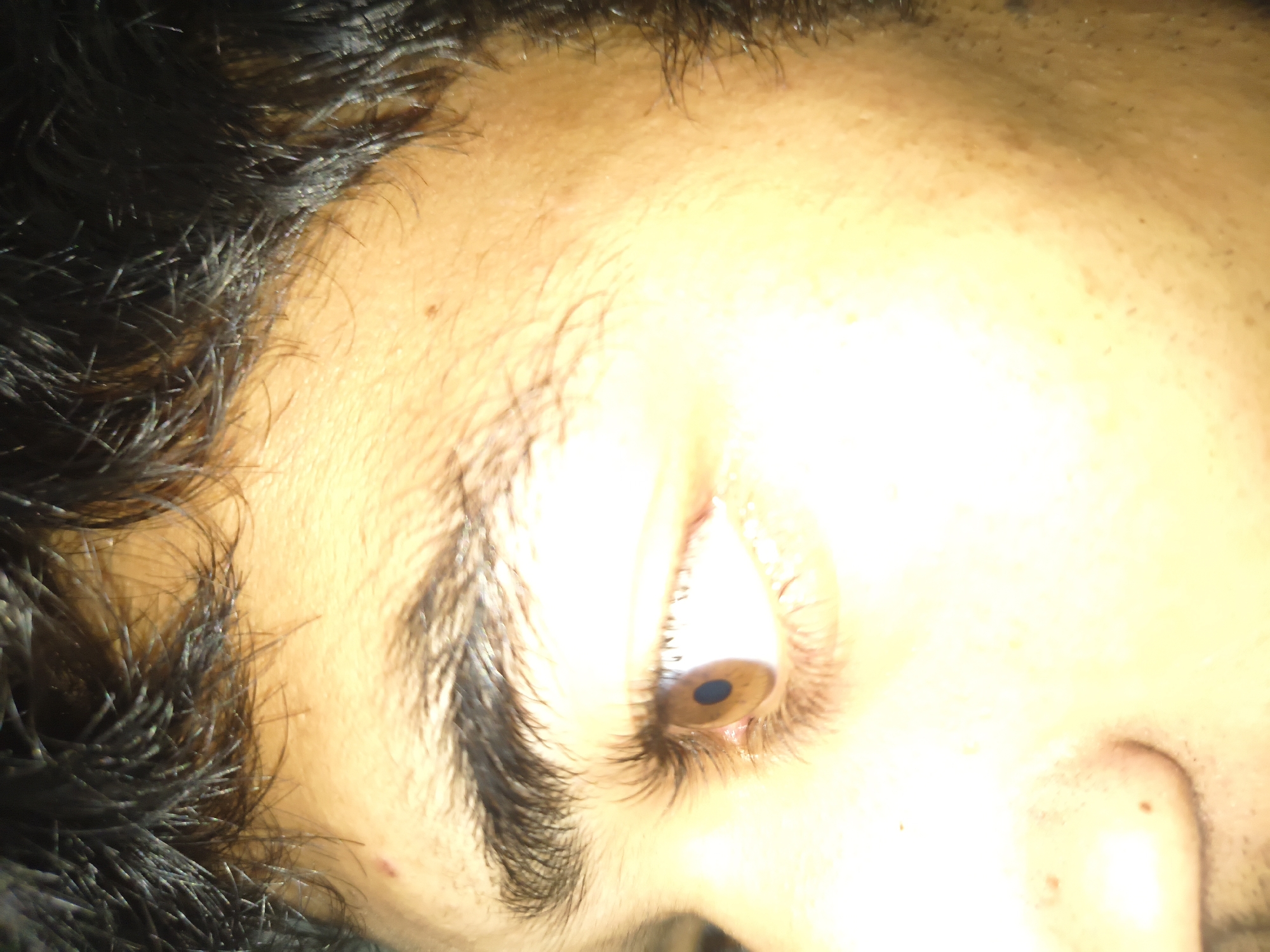 The image is a close-up, side profile of a person's face, focusing on their eye and eyebrow. The skin tone appears to be medium to dark. The eye is open, revealing a brown iris and a black pupil. Eyelashes are visible. The eyebrow is dark and well-defined. Dark hair is visible along the top and right side of the frame, obscuring some of the forehead. There are a few small moles or blemishes visible on the skin. The lighting is bright, creating a halo effect around the eye. The image does not contain any information about the location in Haini, India.