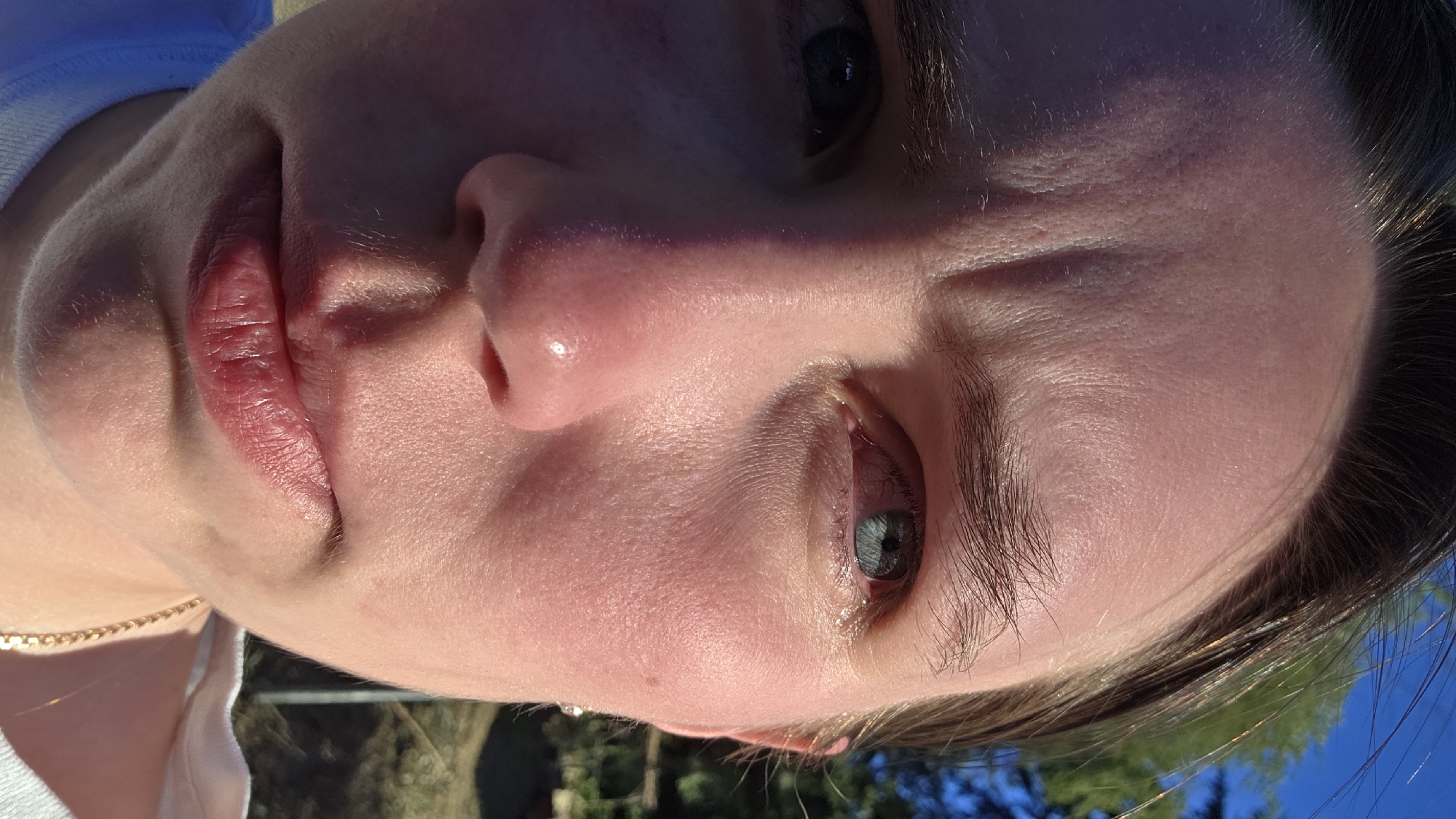This is a close-up, eye-level, outdoor photograph of the face of a person with fair skin and dark hair. The person's gaze is directed towards the camera, with their head tilted slightly downwards and to the left. The lighting is strong and directional, creating shadows and highlighting the contours of the face. The person's right eye appears red and irritated, with visible blood vessels. The left eye is more obscured by shadow. The person has prominent lines on their forehead, and their lips are slightly parted. A portion of a gold chain necklace is visible on the right side of the frame. In the background, out of focus, are green trees and a bright blue sky, suggesting an outdoor setting, possibly a park or backyard. The location in Portland, United States of America is not identifiable from the visual information present in the image.