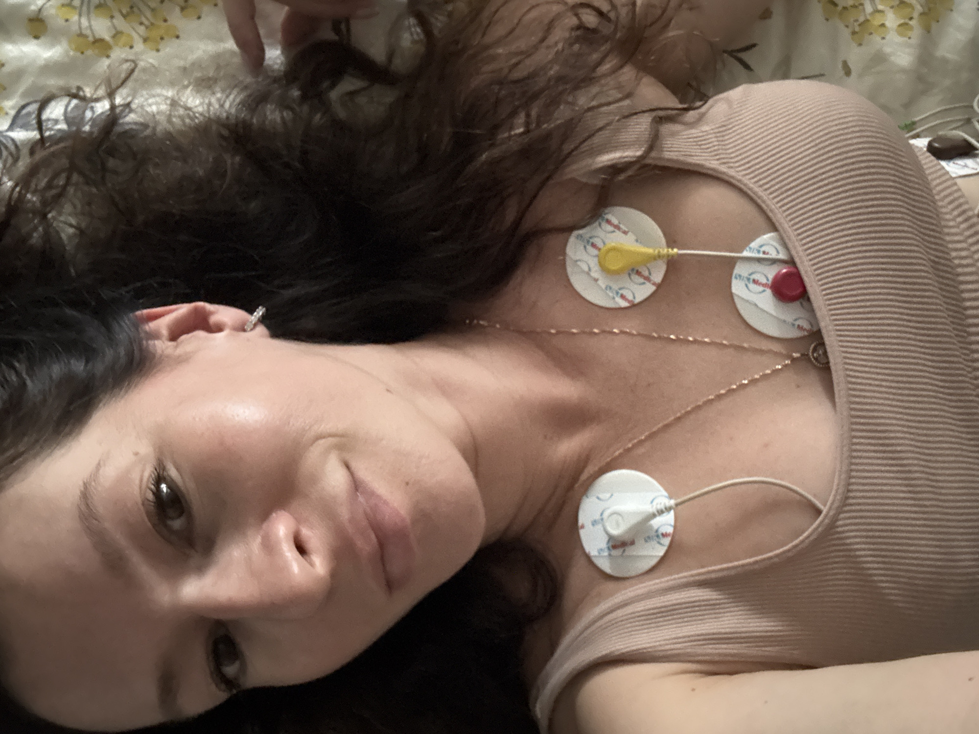 A woman is lying on a bed and looking at the camera. She is wearing a beige tank top and has several medical sensors attached to her chest. The sensors are round and white with red and blue accents. One of the sensors has a yellow lead attached to it, and another has a red component. The woman has long, dark, curly hair and is wearing a small, sparkly earring in her left ear. She is wearing two necklaces, one with a pendant. The background of the image is blurred but appears to be a bed with a patterned duvet. The scene appears to be indoors, in a bedroom. The location is not specified in the image.