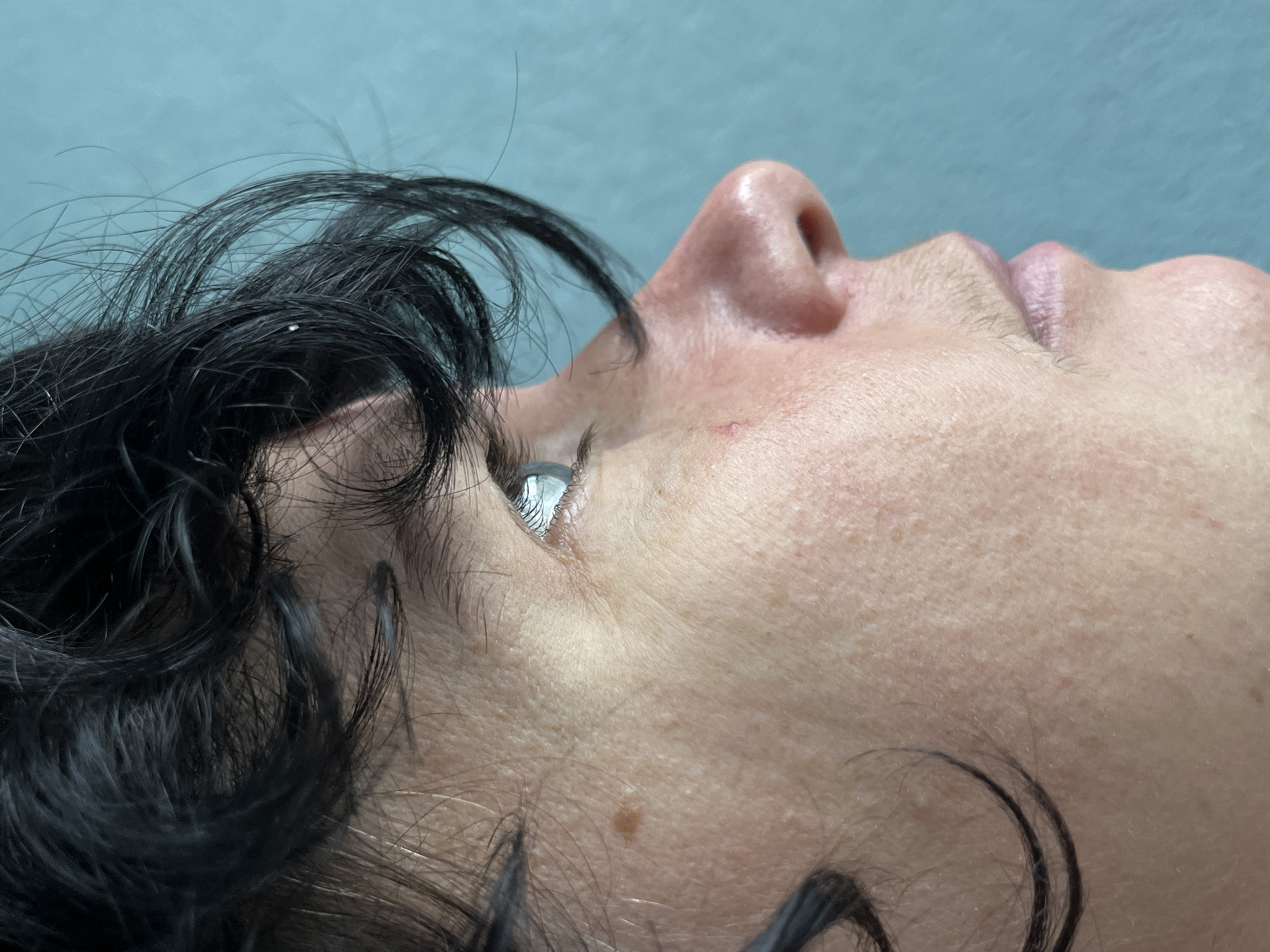 The image is a close-up, profile view of a person's face, positioned on the left side of the frame, against a plain, teal-colored background. The person has dark, curly hair that frames the face and falls across the forehead and cheek. The skin shows texture with visible pores and some fine lines. There is a small, dark mole on the cheek, and some scattered freckles. The eye is visible, with a light-colored iris and defined eyelashes. The nose is prominent, with a slightly bulbous tip and visible nostrils. The lips are slightly parted, revealing a light pink hue, and there appears to be some light facial hair above the upper lip and on the chin. A small, red mark, possibly a scratch or blemish, is visible on the cheekbone. The overall lighting suggests an indoor setting, with the light source likely coming from the front and slightly to the side, creating subtle shadows on the contours of the face. The location of ღრმაღელის თემი, Georgia is not discernible from the visual information present in the image.