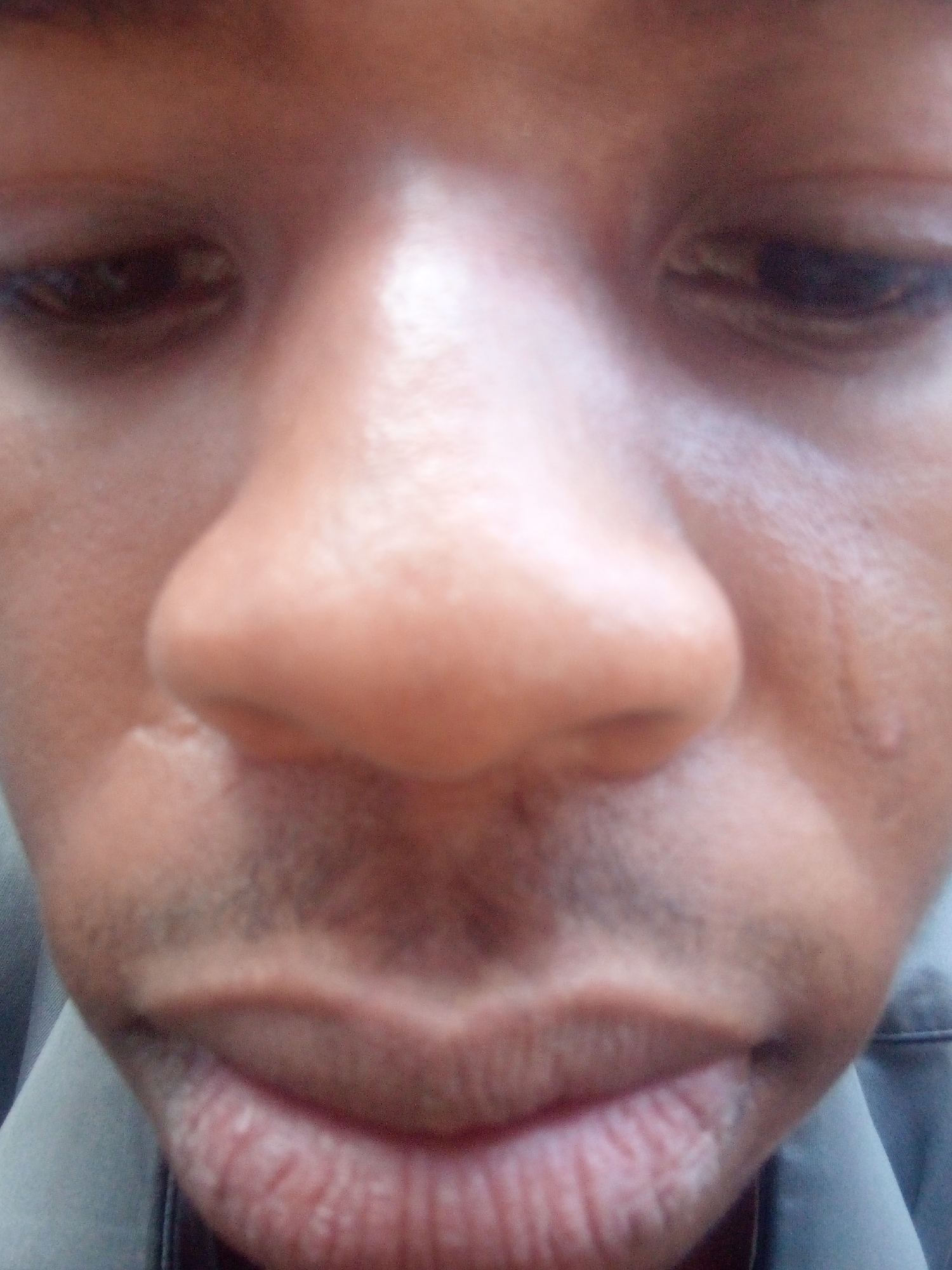 A close-up photo shows a dark-skinned person's face, primarily focusing on the eyes, nose, and mouth. The person appears to be looking down. There are visible scars on the face. The person has a small amount of facial hair. The image shows a portion of a gray shirt. Ikorodu, Nigeria is not visibly indicated in the photo.