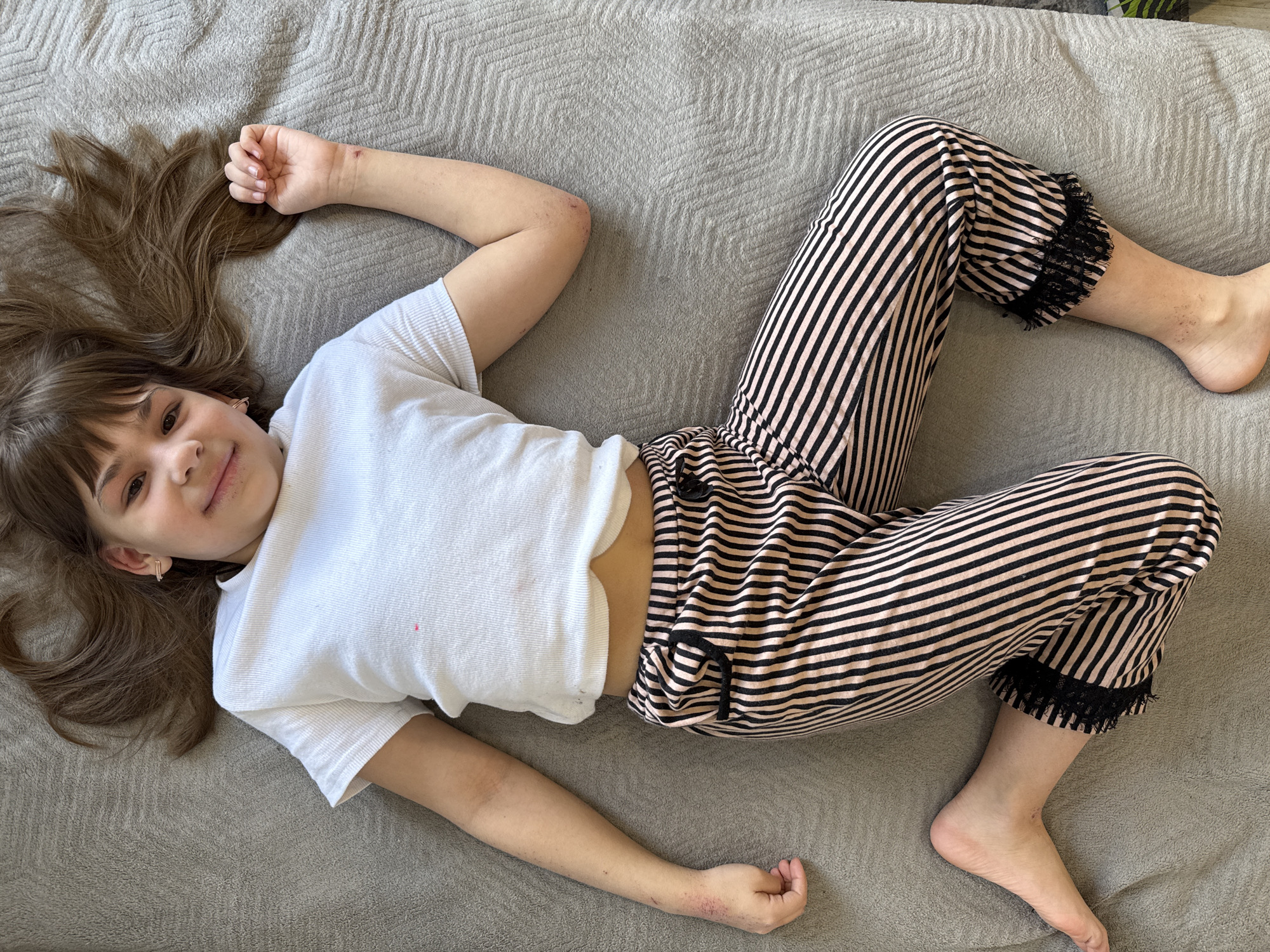 A young girl with light skin, brown hair, and a small smile lies on a gray textured surface, likely a bedspread. She is wearing a short-sleeved white shirt and striped pants with black lace trim at the ankles. She is indoors. No information is available to verify location in Rusanovo, Russia.