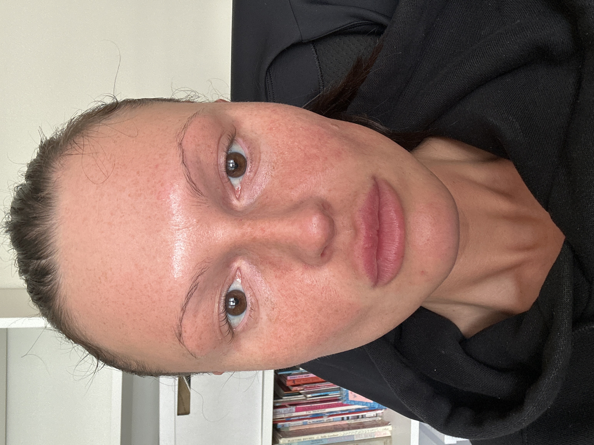 A close-up, indoor shot depicts a light-skinned woman with brown hair pulled back. Her face exhibits some redness and freckles. She has brown eyes and full lips. The background includes a bookshelf with various books, a white cabinet, and a black hooded sweatshirt. The photo was not taken in Wealden, United Kingdom.