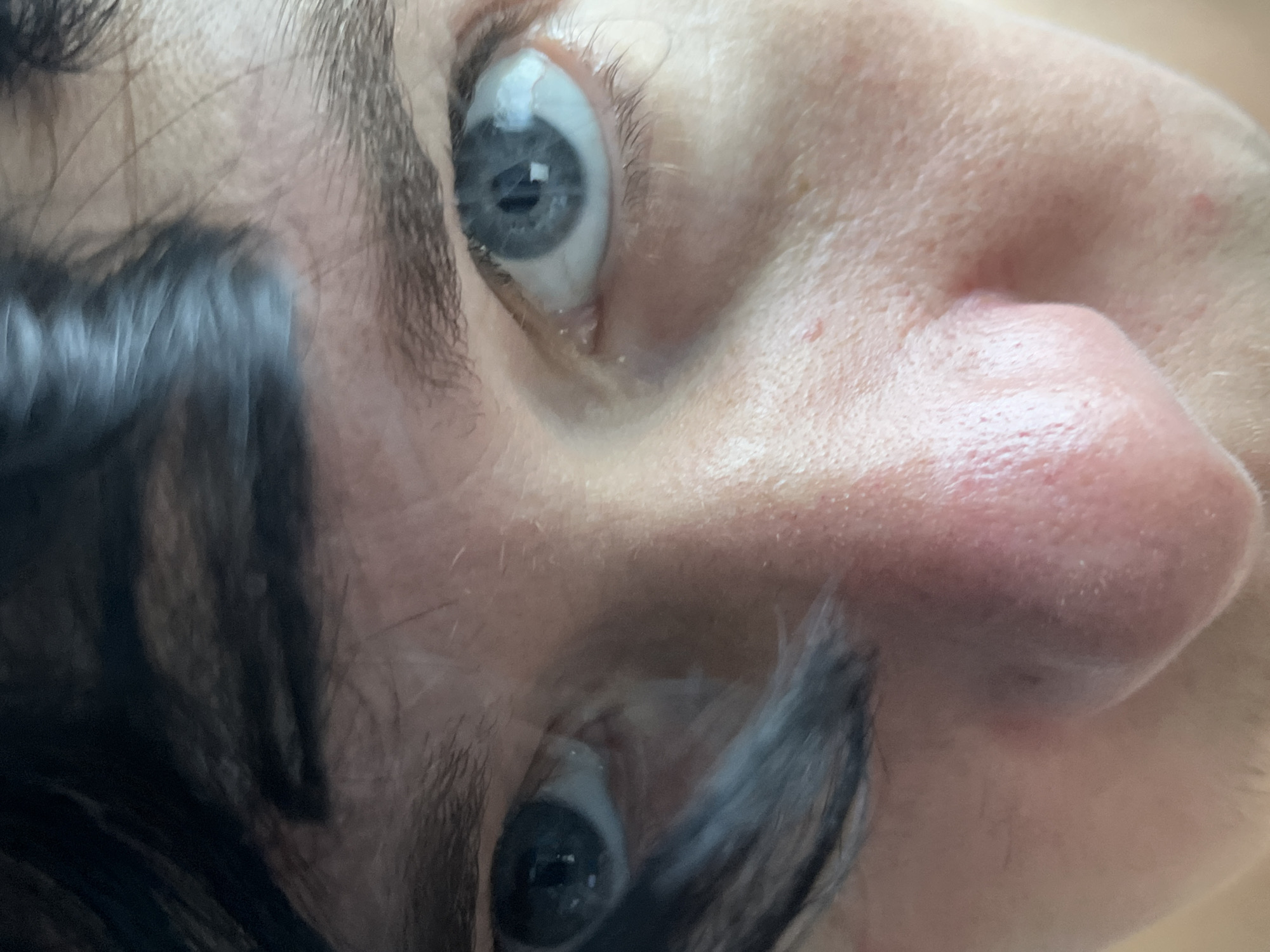 This is a close-up, front-facing photograph of a person's eyes and nose, taken indoors. The lighting suggests it is daytime, possibly natural light. The subject has fair skin with some visible pores and very light blemishes, particularly around the nose. Their eyebrows are dark and somewhat sparse. The eyes are a striking blue-gray color with dark pupils. Dark, wispy hair falls across the left side of the face, obscuring part of the forehead and left eye. The background is out of focus and appears to be a neutral indoor setting. The image does not provide any information about the specific location within ღრმაღელის თემი, Georgia.