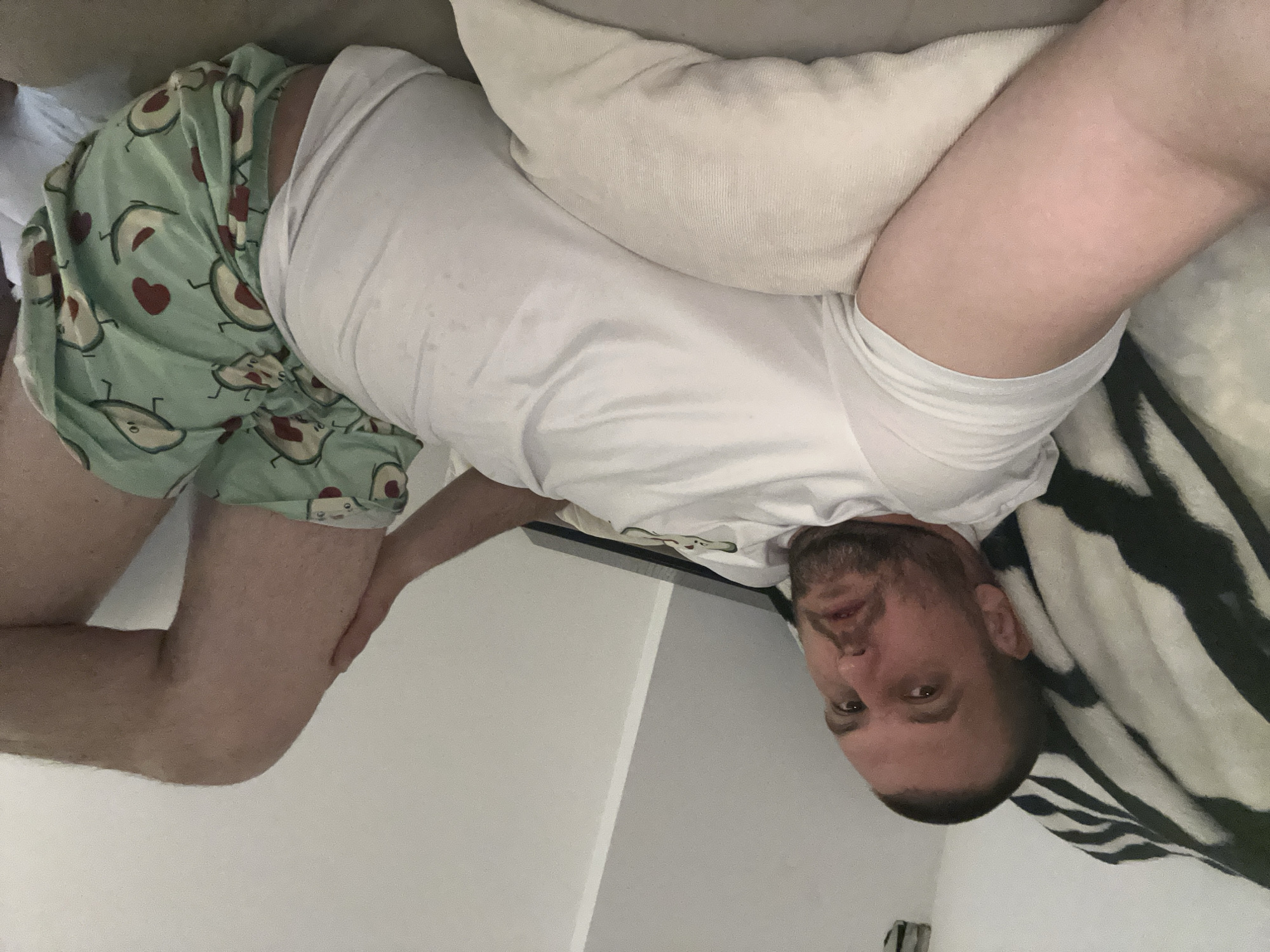 A man is lying on a bed or couch. He is wearing avocado-printed shorts and a white t-shirt. He is partially covered by a blanket with a zebra stripe pattern and is using a white pillow. The location is not discernible from the image and cannot be said to be Sofia, Bulgaria.