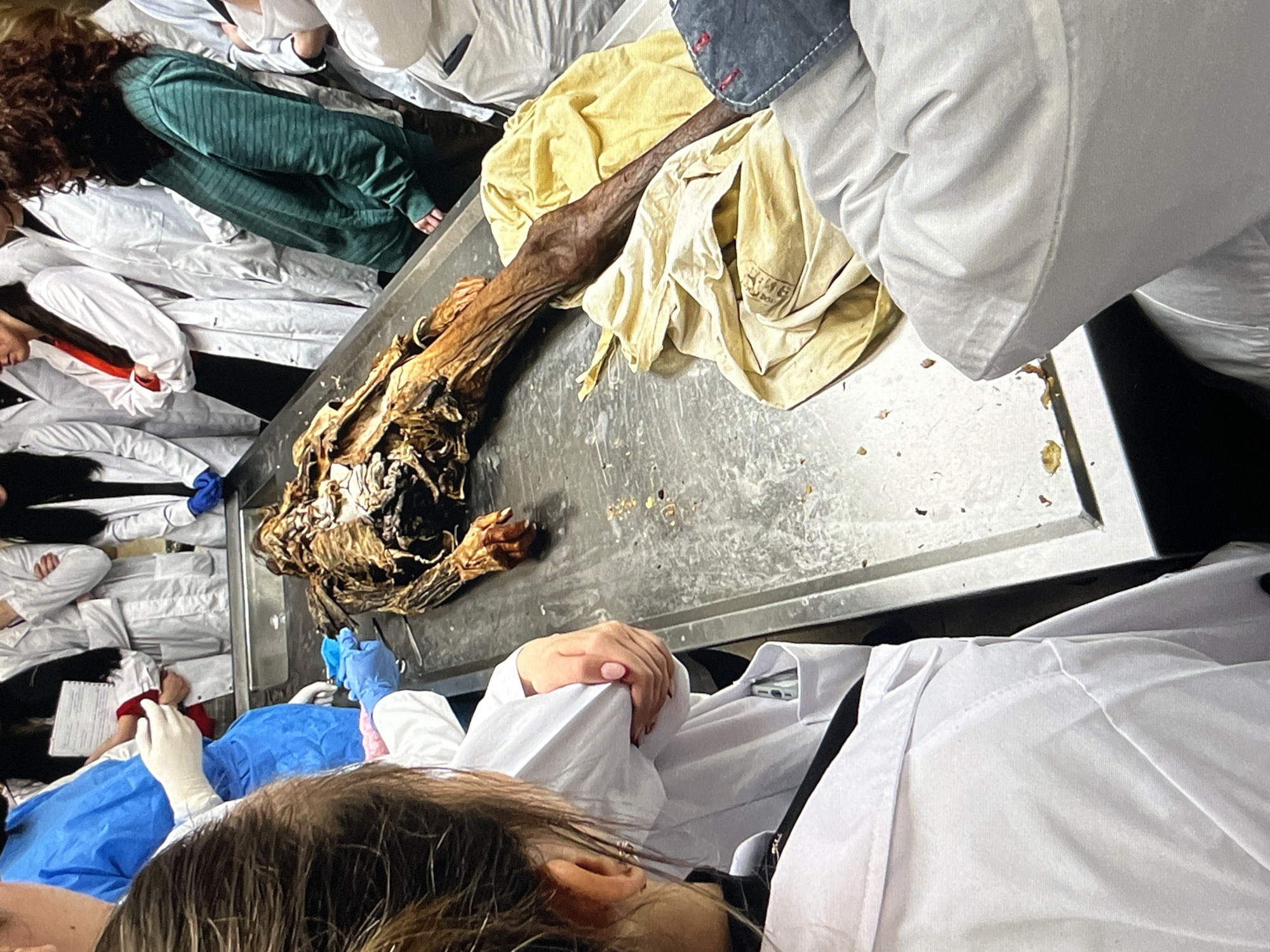 The image shows what appears to be a forensic or anatomical examination scene. A cadaver or partially disarticulated human remains are lying on a metal table, possibly in a laboratory or medical facility. Multiple individuals in lab coats are observing and/or participating in the examination. Some are wearing gloves. The environment suggests a sterile, scientific setting. The location is Unknown, Unknown.