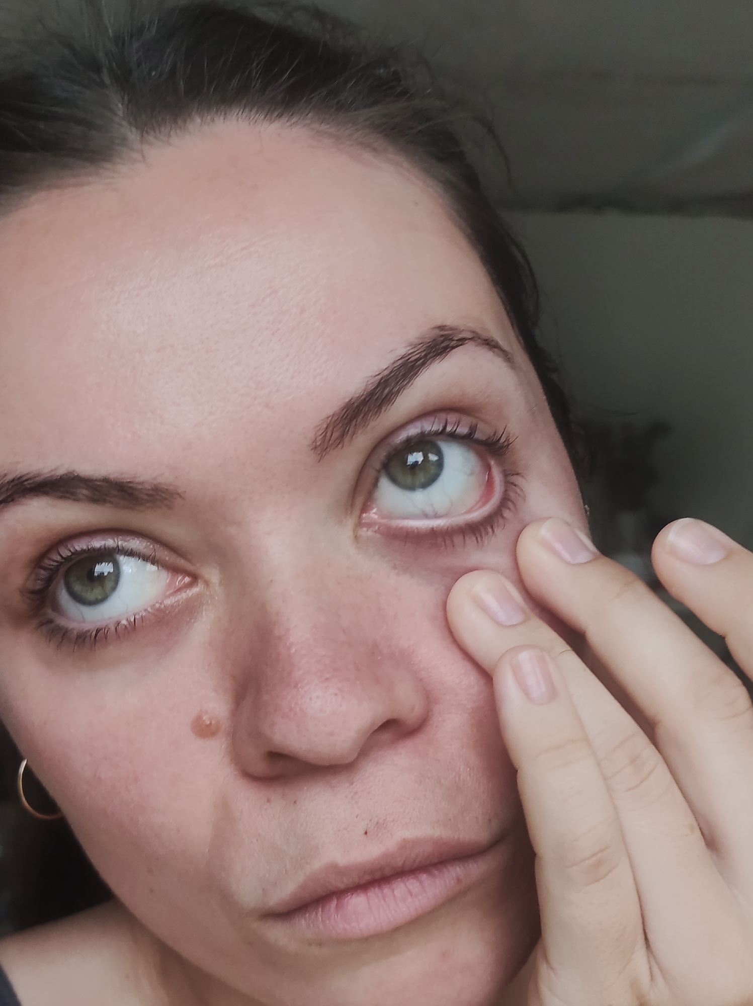 A close-up portrait of an adult female captures her face and left hand. She has fair skin, dark eyebrows, and green-hazel irises. A small, raised, flesh-toned lesion is visible on her right cheek, inferior to her right nostril. Her left hand (viewer's right) is positioned against her face, with the index and middle fingers gently pulling down the skin directly beneath her left eye. This action reveals mild redness and visible blood vessels in the lower conjunctiva of her left eye. Her right eye appears normal, and both eyes are looking upwards and slightly to the left. A gold-colored hoop earring is visible in her left ear. Her lips are slightly parted, and her expression is neutral. The background is dark and out of focus, providing no discernible environmental details. The image contains no information regarding the city of Фоки, Russia, or any other specific location.