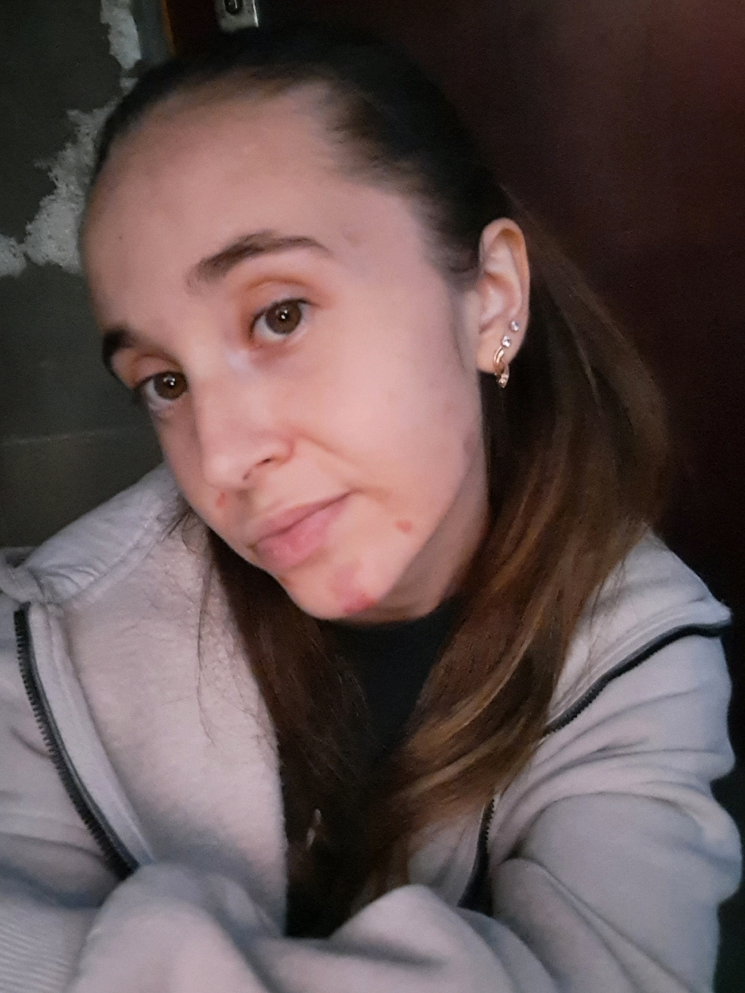 The image shows a close-up, slightly off-center, selfie of a young woman with brown hair pulled back and a light-colored zip-up hoodie. She has brown eyes, light skin with some redness and blemishes on her chin and cheeks, and she is wearing a small gold hoop earring with a charm and a second small stud earring in her left ear. The background is dark and appears to be indoors, with a blurred wall texture and a dark doorway or corner to the right. The lighting is dim and appears to be coming from the front, casting some shadows. The woman's expression is neutral, with her lips slightly parted. The image is of low quality, with visible noise and a lack of sharp detail. There are no identifiable landmarks or clues within the image that would suggest a specific location in Vypasne, Ukraine.