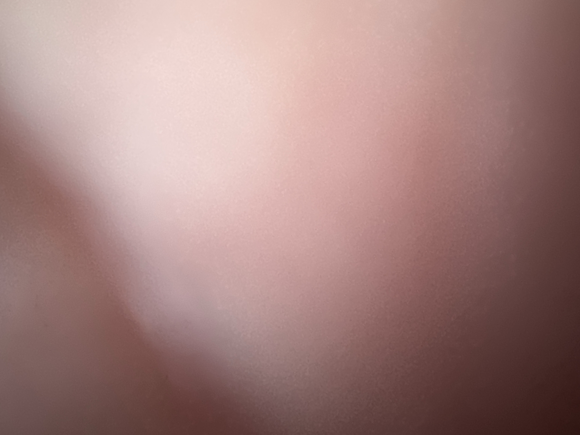 The image is an abstract, out-of-focus close-up of skin, likely human. The color palette consists of soft pinks, beiges, and a darker reddish-brown. There are no discernible objects, people, or actions. The lighting creates a gradient effect, with a brighter area on the right and a darker area on the left. The texture appears slightly grainy. There is no discernible location within the city of Belgrade, Serbia, or any other identifiable setting.