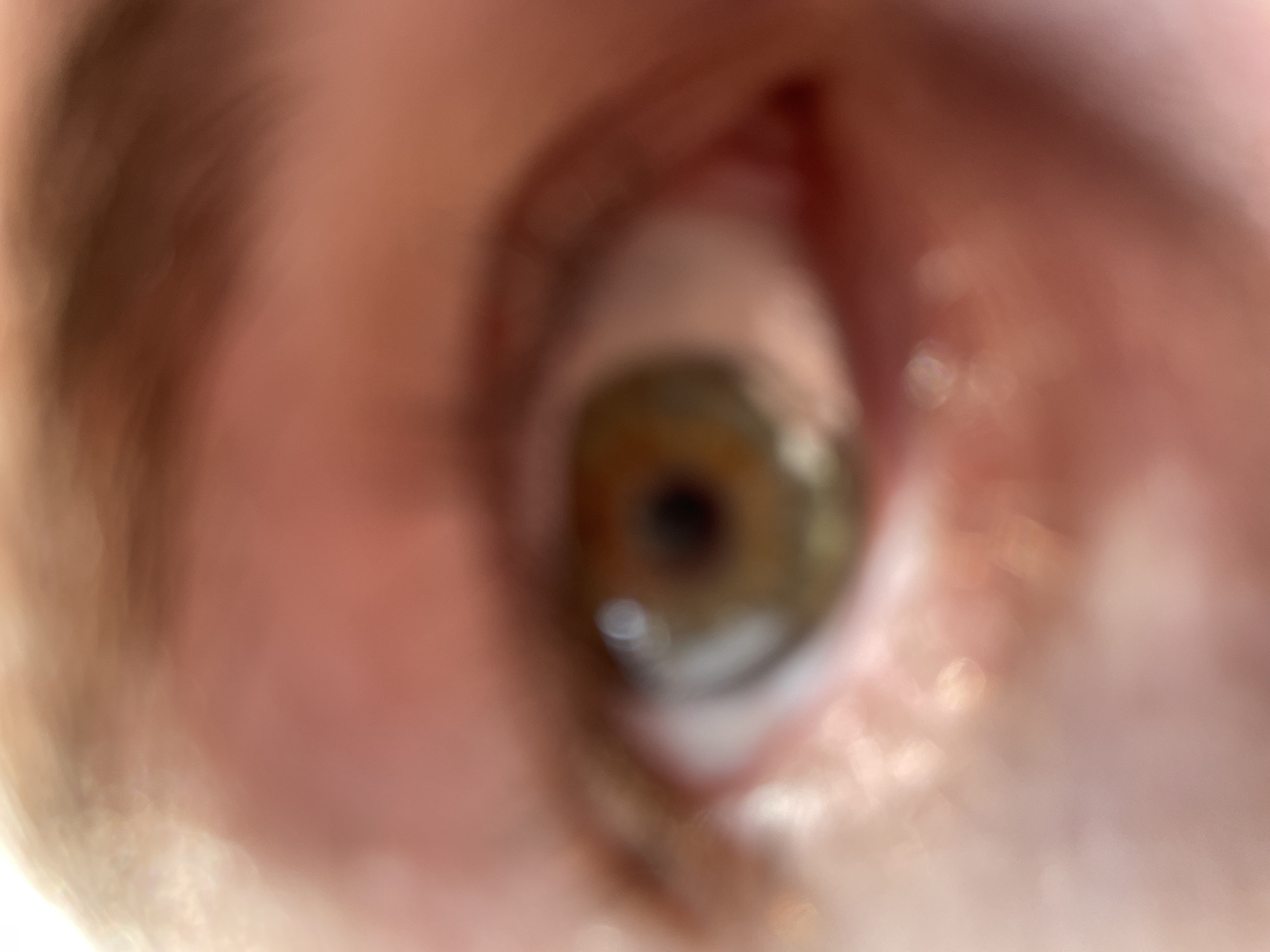 The image shows a blurred close-up of a human eye with a hazel iris. The surrounding skin and eyelashes are also blurred. There is no indication of location.