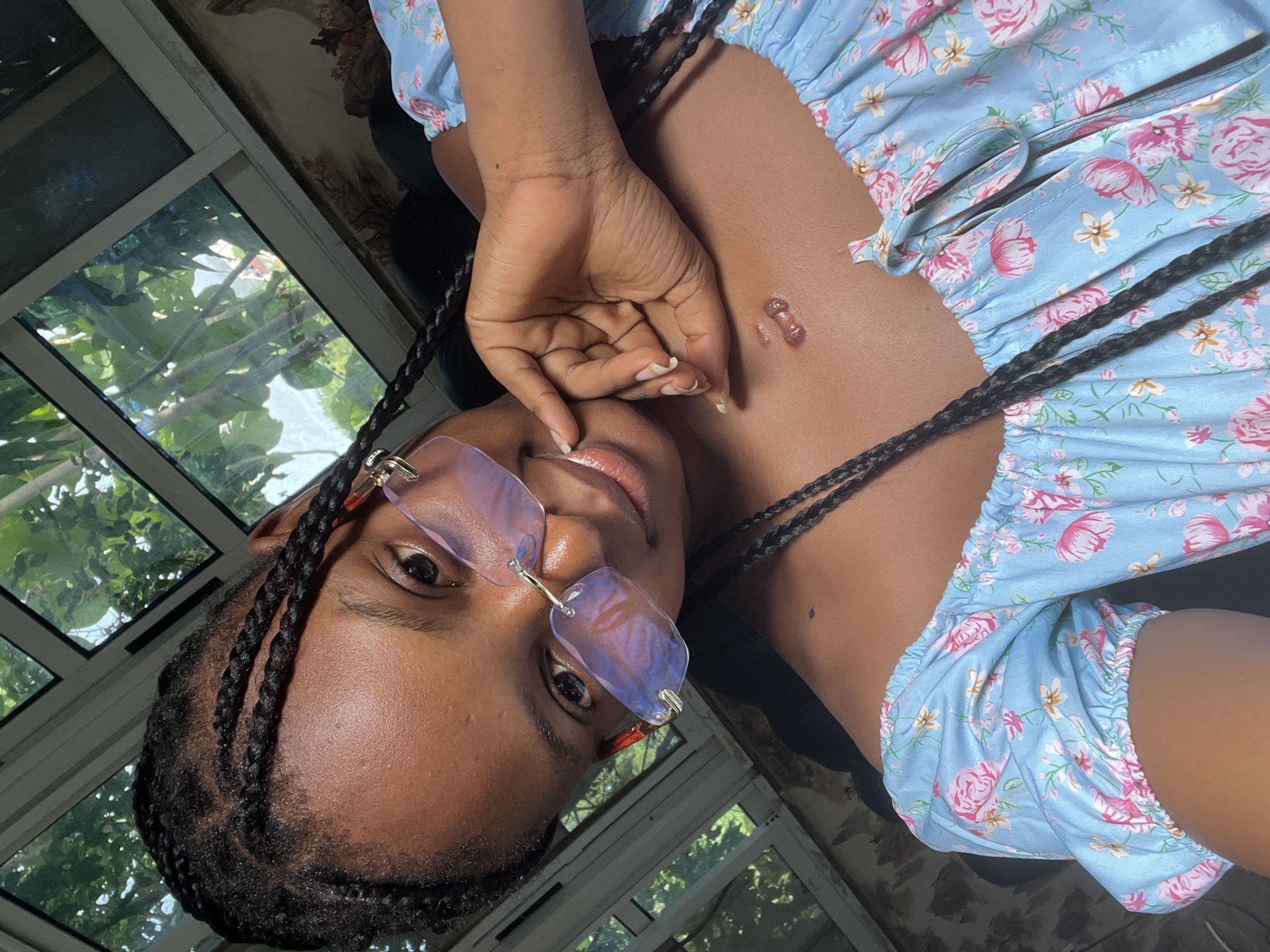 A young woman is posing for a portrait. She is wearing clear-framed glasses with an orange tint. Her hair is styled in braids. She is wearing a light blue floral top. She has a scar on her chest. There is a window behind her with a view of trees. The image was taken indoors. It is impossible to tell if the location is in the city of Adankolo, Nigeria.