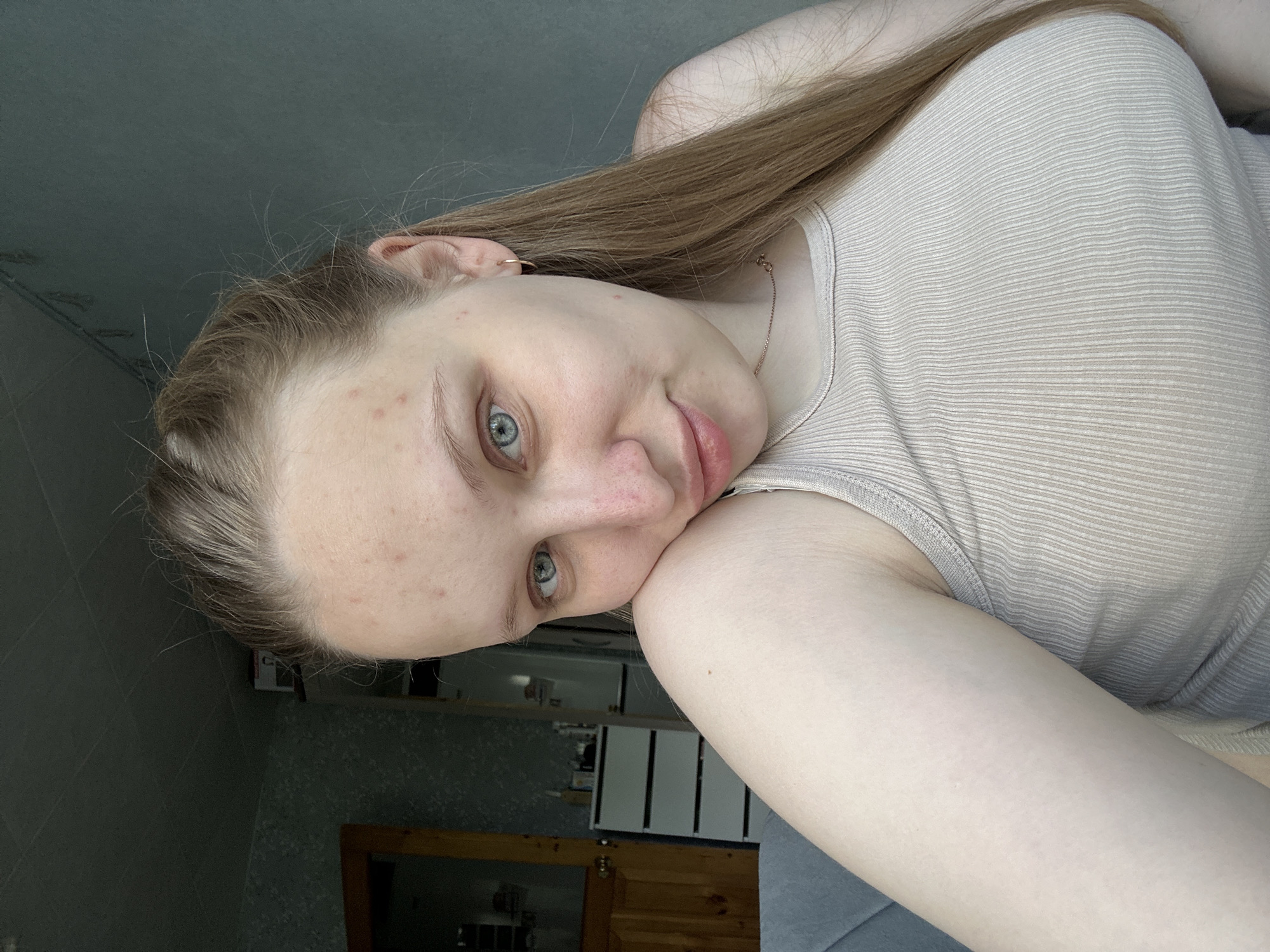 A young woman with light skin and blue eyes is seen from a close-up, angled perspective. She is wearing a light-colored, horizontally striped tank top. Her long, light brown hair is styled straight and falls over her shoulder. She has a gold hoop earring in her left ear and a gold necklace around her neck. Her face shows some skin imperfections, including redness. The background suggests an indoor setting, possibly a domestic environment. The location is Chaikovsky, Russia. The specific action is the subject posing for a selfie or photo.