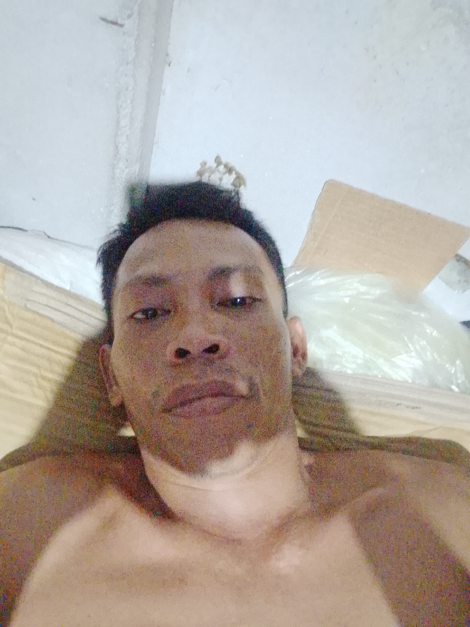 A medium, close-up shot depicts a dark-skinned man with black hair, lying down. The man appears shirtless and is facing the camera. Patches of lighter skin are visible on his face. Behind him is a tan mat and a large, clear plastic bag. A piece of cardboard is also visible. The background shows a white ceiling and wall. The location is Bukit Ketok, Indonesia.