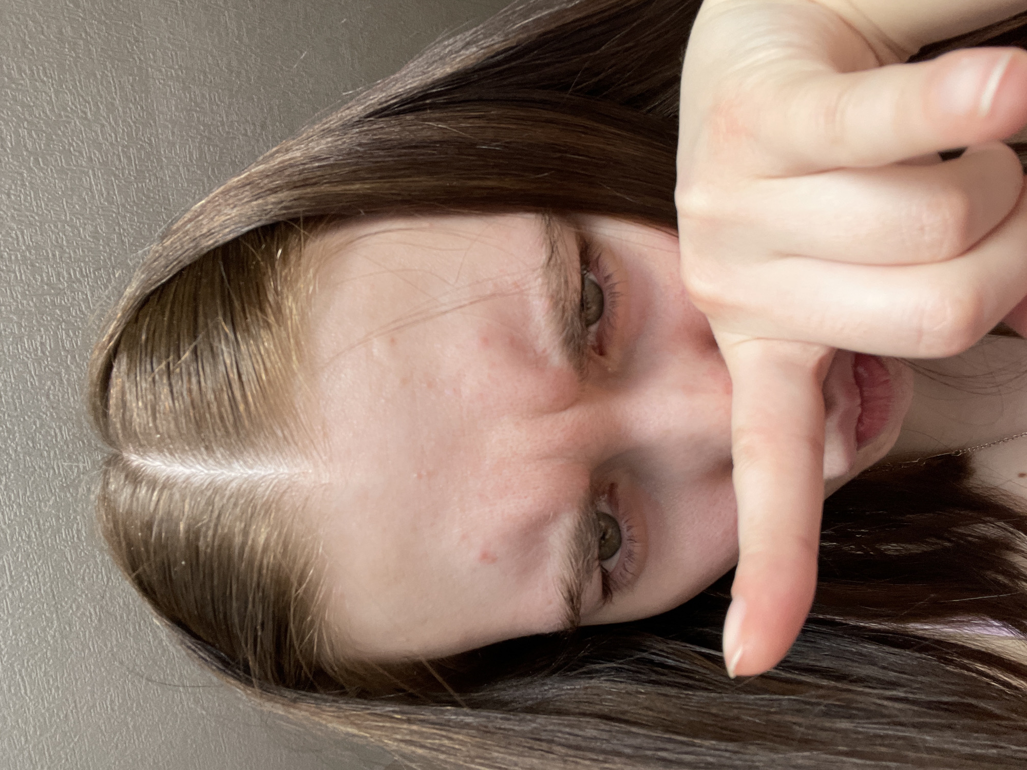 A close-up, selfie-style photograph shows a fair-skinned person, likely female, with brown hair parted at the center. The person's face is oriented diagonally with their left side appearing higher in the frame. Their eyes are hazel, and their eyebrows are light brown. There are some minor skin blemishes visible on their forehead and cheek. The person's hand is in the foreground, obscuring the right side of their face. The index finger is extended downward. The background is a plain, light-colored wall. There is no discernible context indicating this photo was taken in Chaikovsky, Russia.