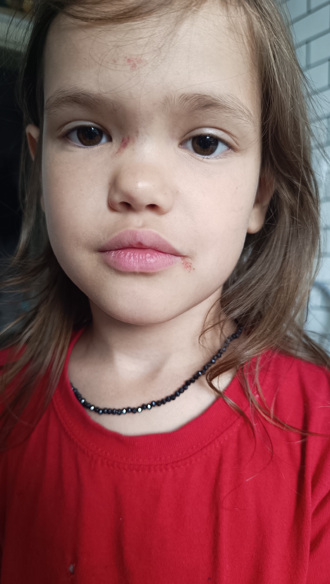 A close-up, chest-up shot shows a young girl wearing a red t-shirt and a black beaded necklace. The girl has brown eyes and long, light brown hair. There are small abrasions on her forehead and on the right side of her upper lip. The background is out of focus and appears to be a light-colored tiled wall. The image was taken in Chaikovsky, Russia.