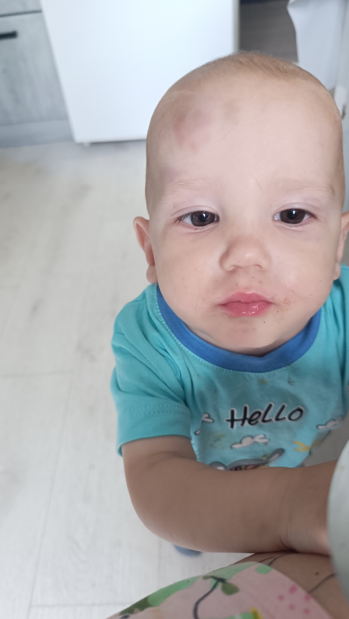 A close-up, high-angle shot captures a baby wearing a turquoise t-shirt with a blue collar and a "Hello" graphic. The baby's head is tilted back, looking upwards. The baby has a noticeable bruise or birthmark on its forehead. The baby's face shows some smudges around the mouth and chin, possibly from food. The background consists of a light-colored floor with vertical planks and a blurred white cabinet or wall. The image is taken indoors, likely in a residential setting within the city of Chaikovsky, Russia.