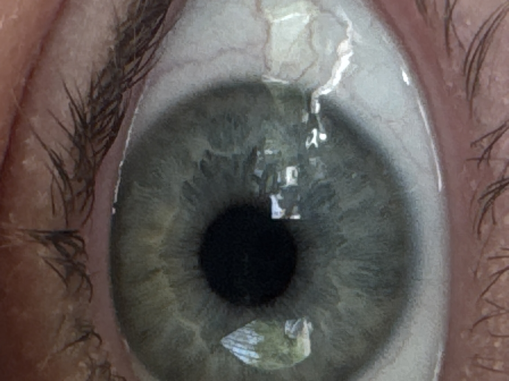 A close-up photograph shows a human eye, with visible eyelashes, iris (gray/green in color), and pupil (black). There are reflections on the surface of the eye. It is impossible to determine the location in the city of Balakhna, Russia from the given image.