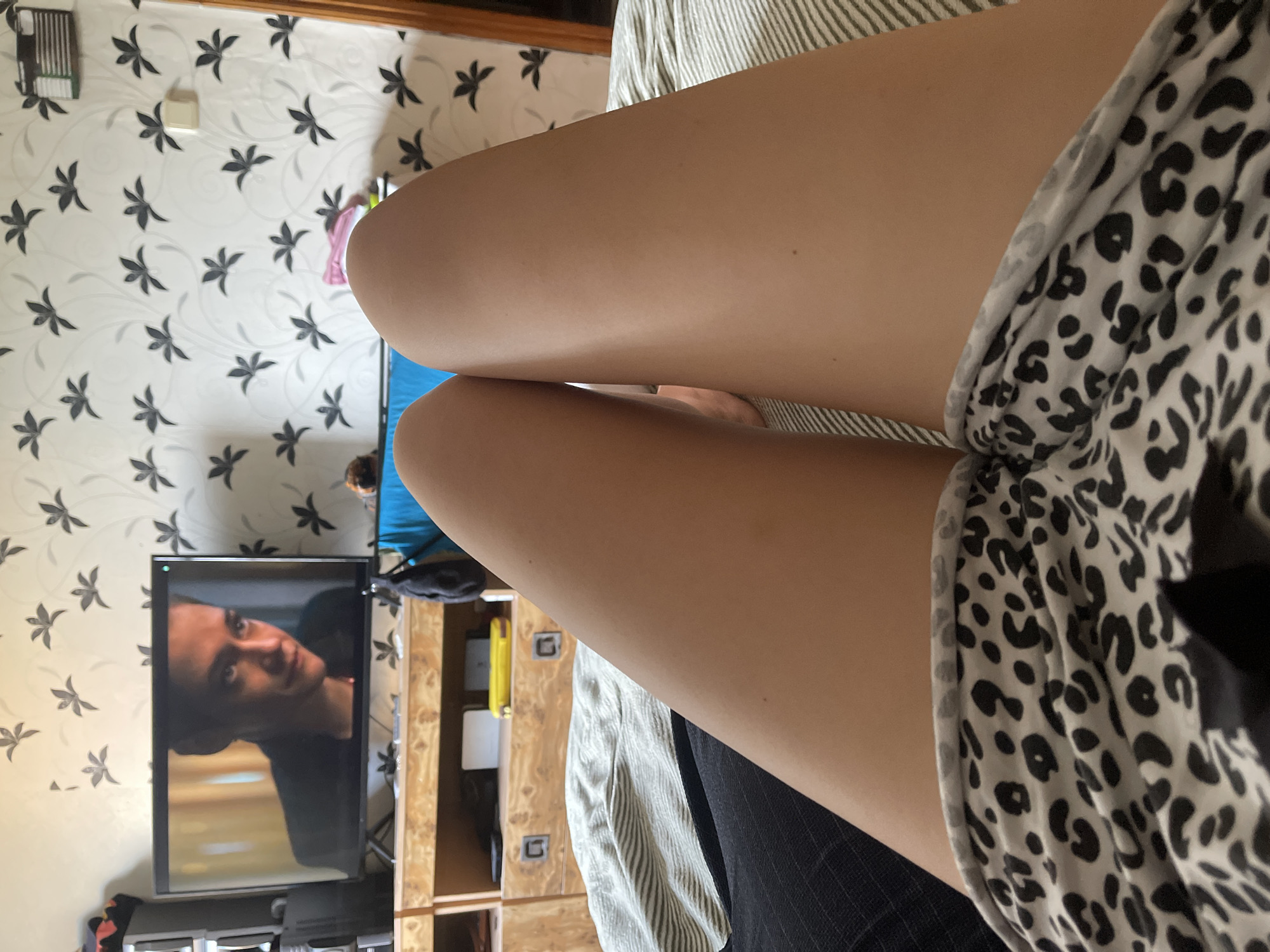 The image depicts a first-person perspective of a person lying on a bed, with their legs and shorts prominently featured in the foreground. The person is wearing leopard-print shorts. In the background, a television screen displays a scene from a movie or show, featuring a person's face. To the left of the television, a piece of electronic equipment is visible. Behind the television, a wall with a floral wallpaper pattern is seen, along with a light switch. Further to the right, a wooden cabinet or dresser is partially visible. The scene appears to be an indoor setting, likely a bedroom or living room, in the city of Shcherbinka, Russia.