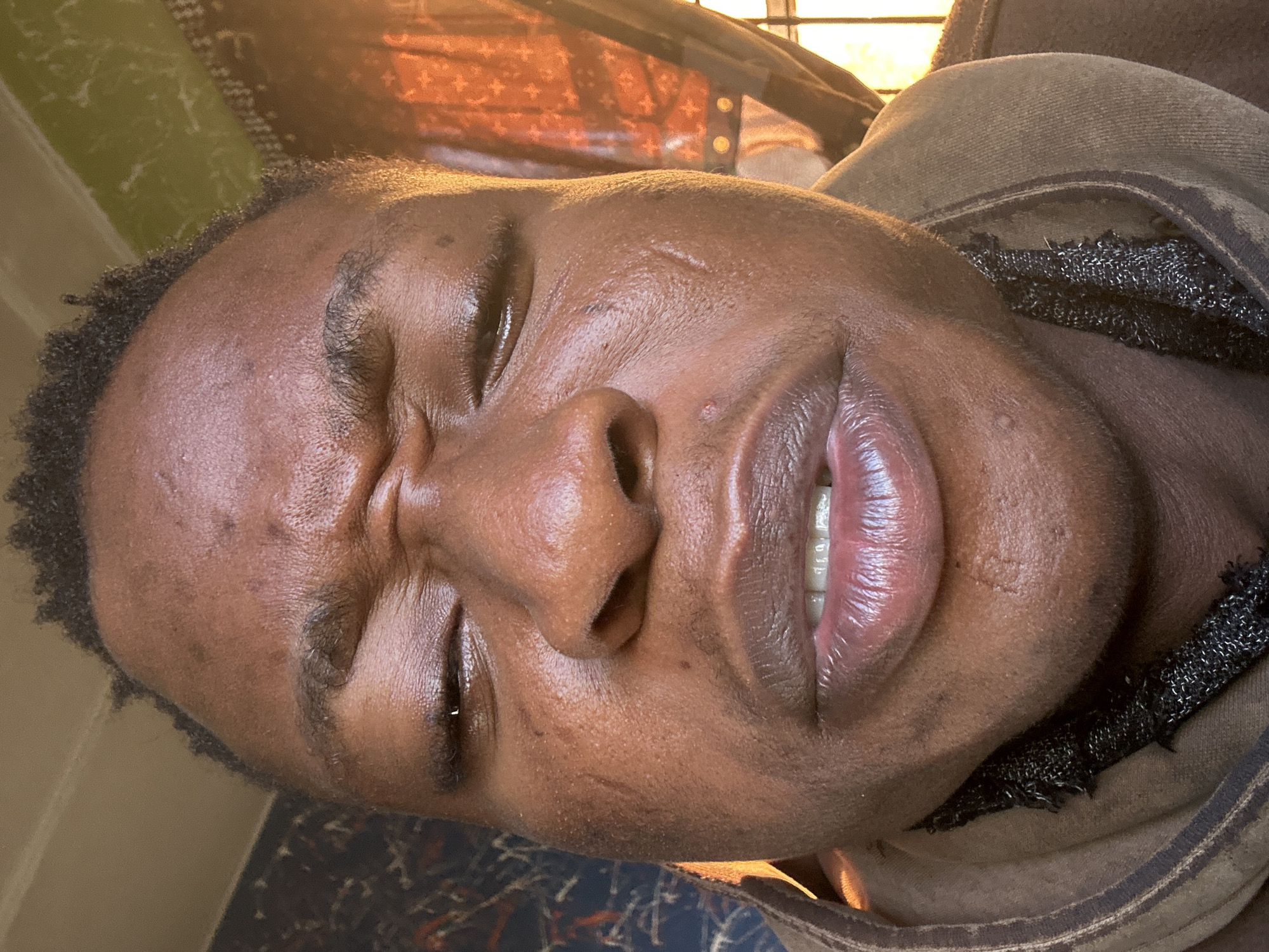 A close-up photograph shows a person with dark skin and short, dark hair, lying down with their eyes closed. The person's face is the main subject, and the image captures their facial features, including a prominent nose, closed eyes, and slightly parted lips revealing some teeth. The lighting suggests an indoor environment, possibly near a window, as evidenced by the light reflecting on the skin. The background is blurred, but hints of bedding and a garment with mesh-like detail are visible. The location is Unknown, Unknown.