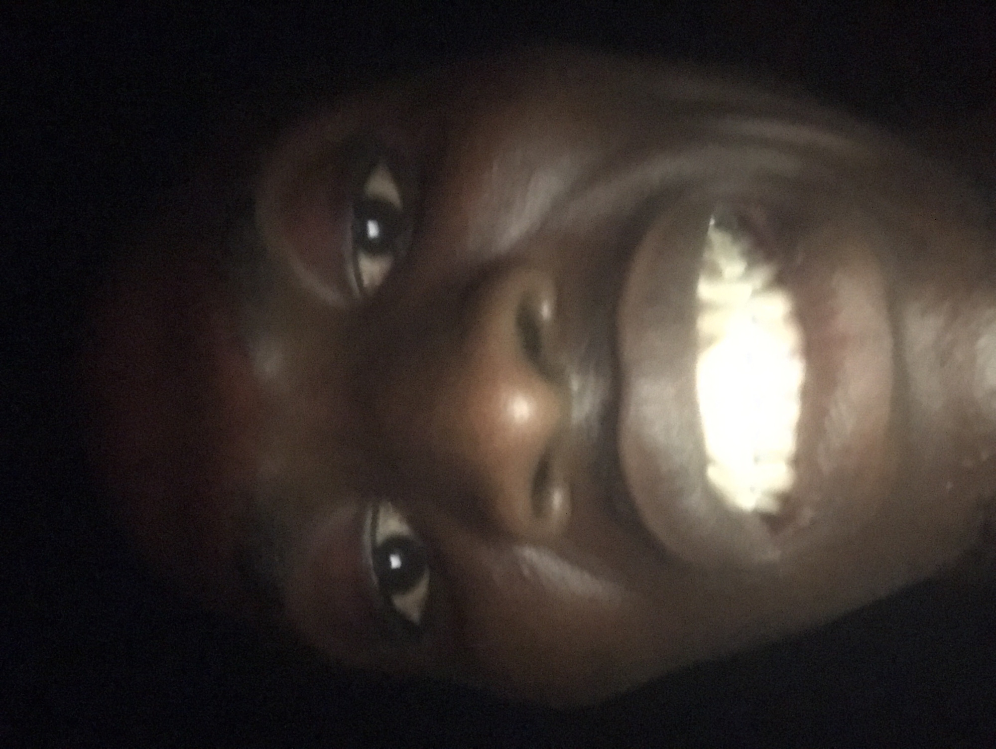 A close-up, rotated portrait of a dark-skinned person's face is depicted in a very low-light environment. The image is rotated clockwise, showing the person's head tilted sideways. The subject is smiling broadly, revealing a prominent set of brightly illuminated teeth, which contrast sharply with the surrounding darkness. One eye is clearly visible, dark with a distinct reflection in the pupil, indicating a light source. The person's nose is also visible. The skin appears somewhat shiny in places where light catches it. The background is completely black and indistinct, providing no clues about the setting. The strong, direct light on the teeth suggests the use of a flash or a focused light source. There is no visible text or discernible objects other than the person's facial features. The overall impression is a cheerful or amused expression captured in an intimate, dark setting.