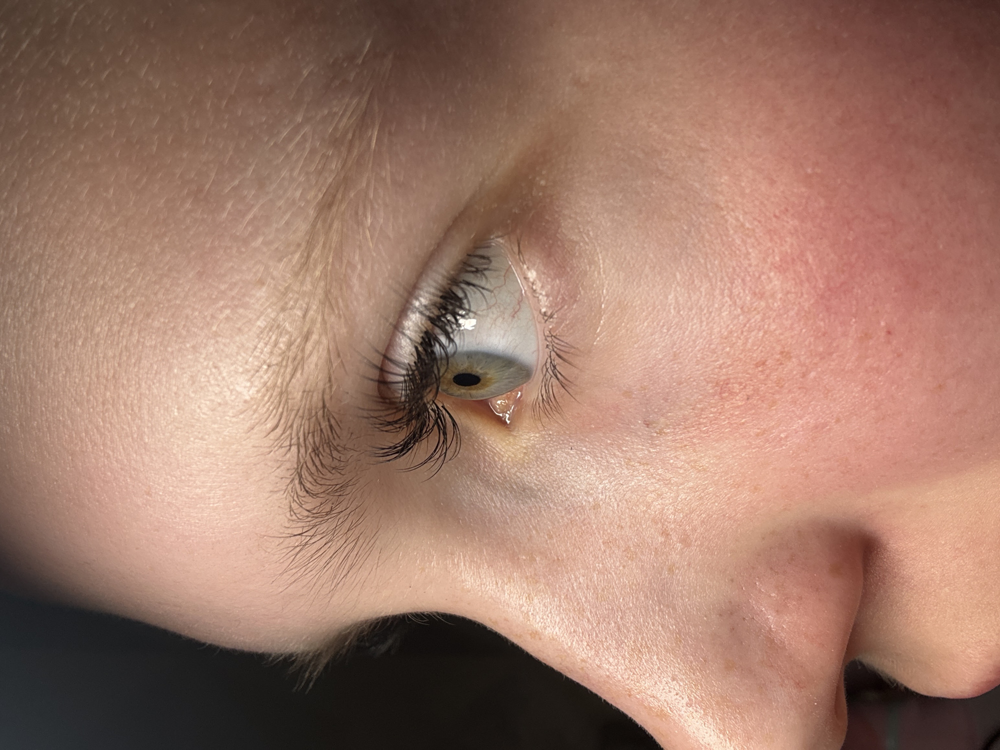 A close-up, angled shot of a person's eye, positioned upward and to the side. The eye is light-colored with dark eyelashes. A single tear is visible at the corner of the eye. The surrounding skin appears fair with subtle variations in tone. The nose is partially visible at the bottom of the frame. The background is dark and out of focus. There is no information available that associates this image with the city of Chaikovsky, Russia.