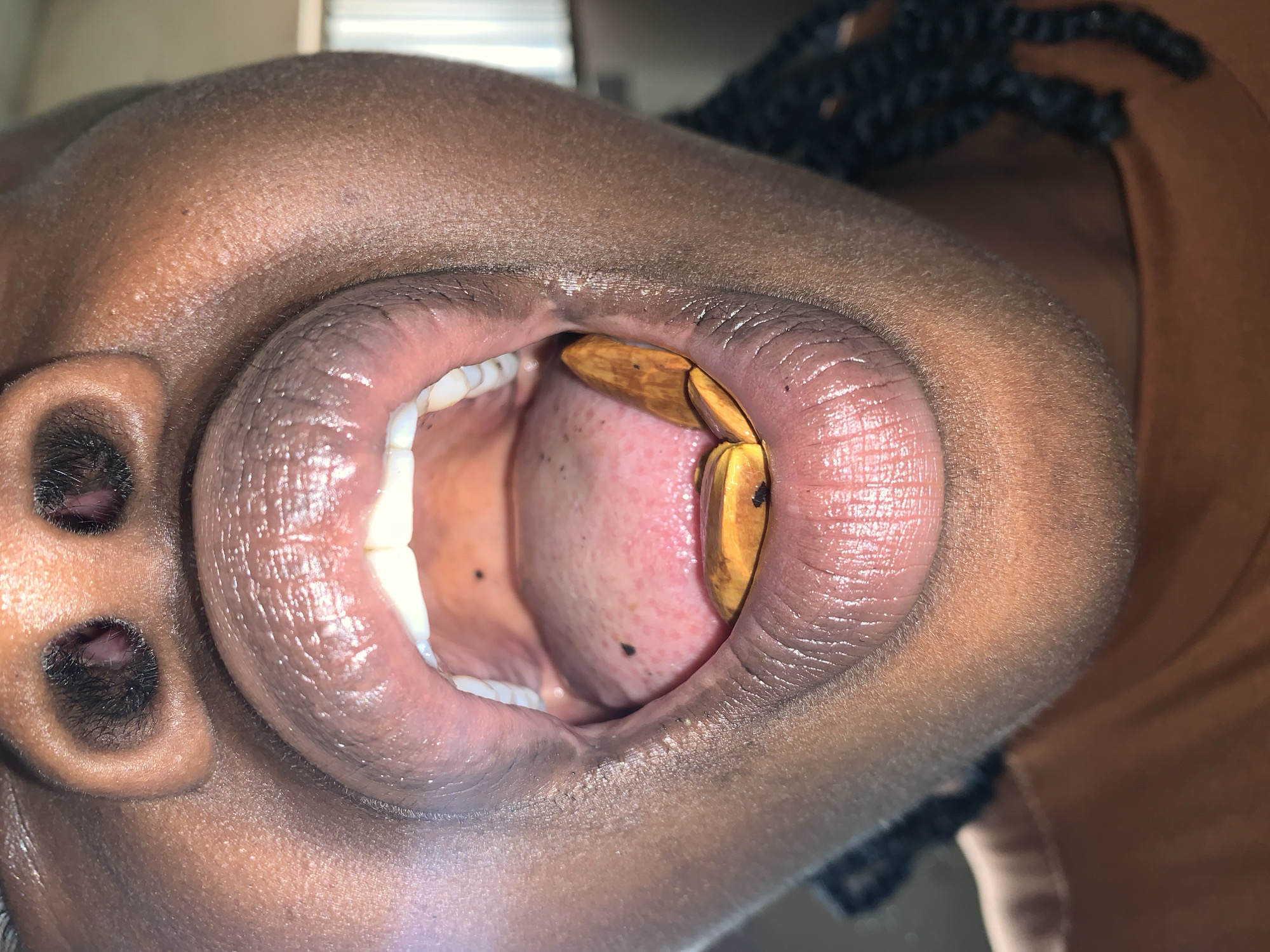 An extreme close-up depicts the lower face of a person with dark skin, viewed from a low angle looking upwards. The nostrils are visible from below, containing coarse, dark nasal hair. The mouth is opened wide, revealing the upper teeth, a pink tongue with scattered dark particulate specks, and the interior of the oral cavity. The full lips appear moist and exhibit visible texture, with several vertical lines visible on the lower lip. Resting on the lower lip and extending slightly onto the front of the tongue are multiple small, irregularly shaped objects with a golden-orange metallic sheen, appearing smooth and somewhat rounded. Dark braided hair is visible on the right side of the frame, out of focus. A portion of a plain, rust-colored garment is visible below the chin. The background is significantly out of focus, showing diffuse light and faint vertical elements, possibly from a window or wall panel, suggesting an indoor environment.